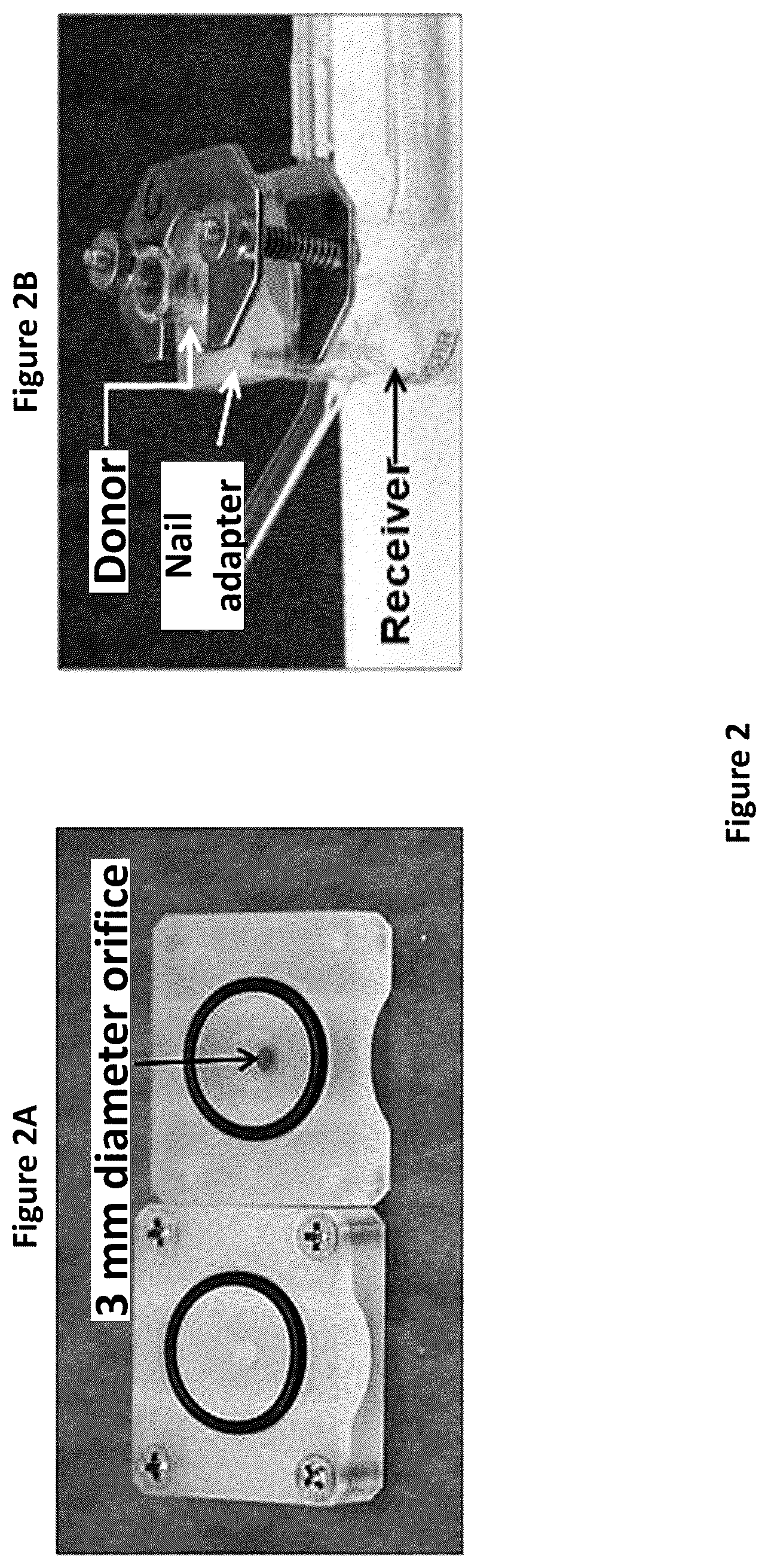 Patent US12303491 Figure 2 – Econazole nitrate medical patch and methods of use thereof