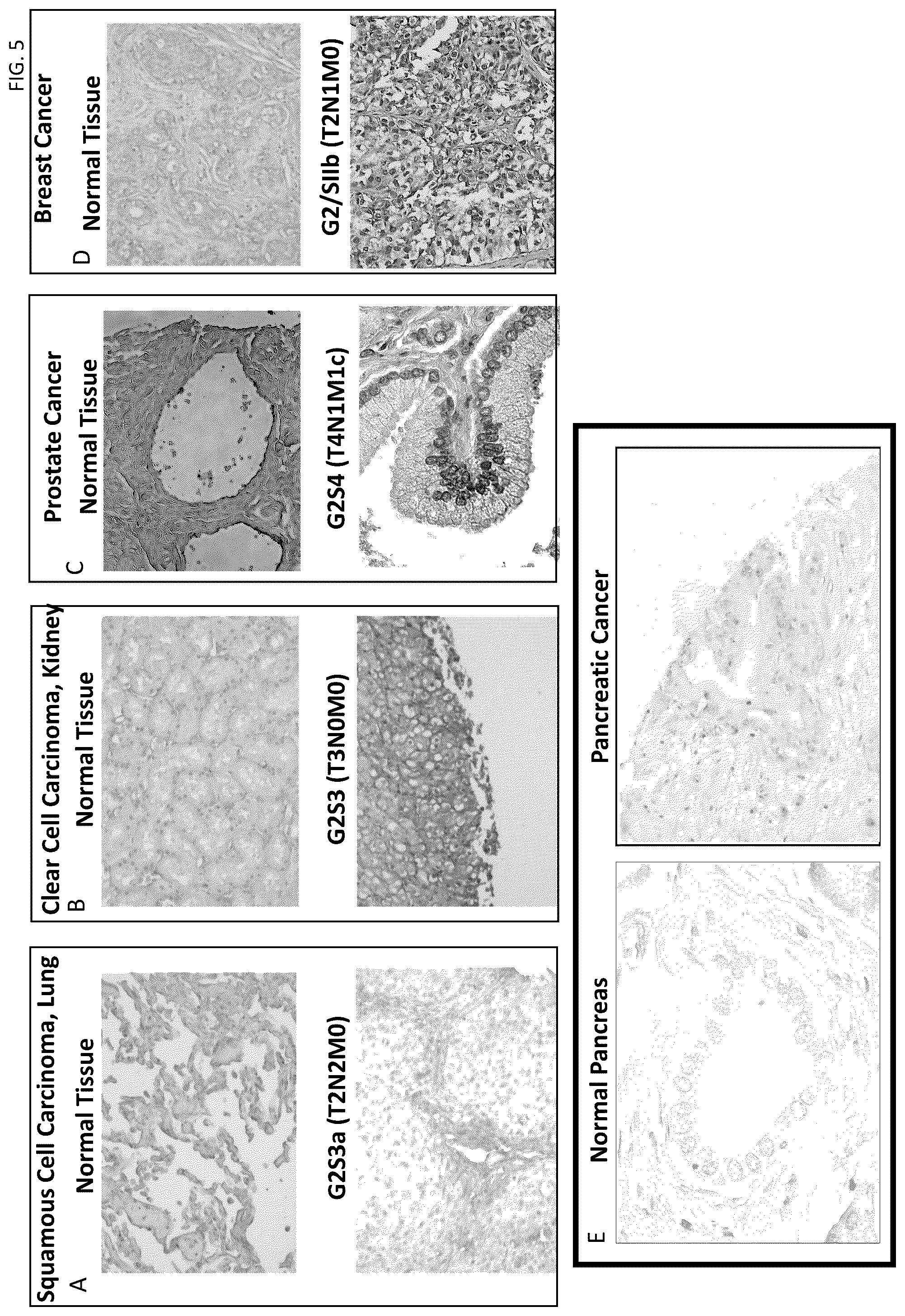 Patent US12303494 Figure 5 – Compositions and methods for monitoring, diagnosis, prognosis, detection, and treatment of cancer