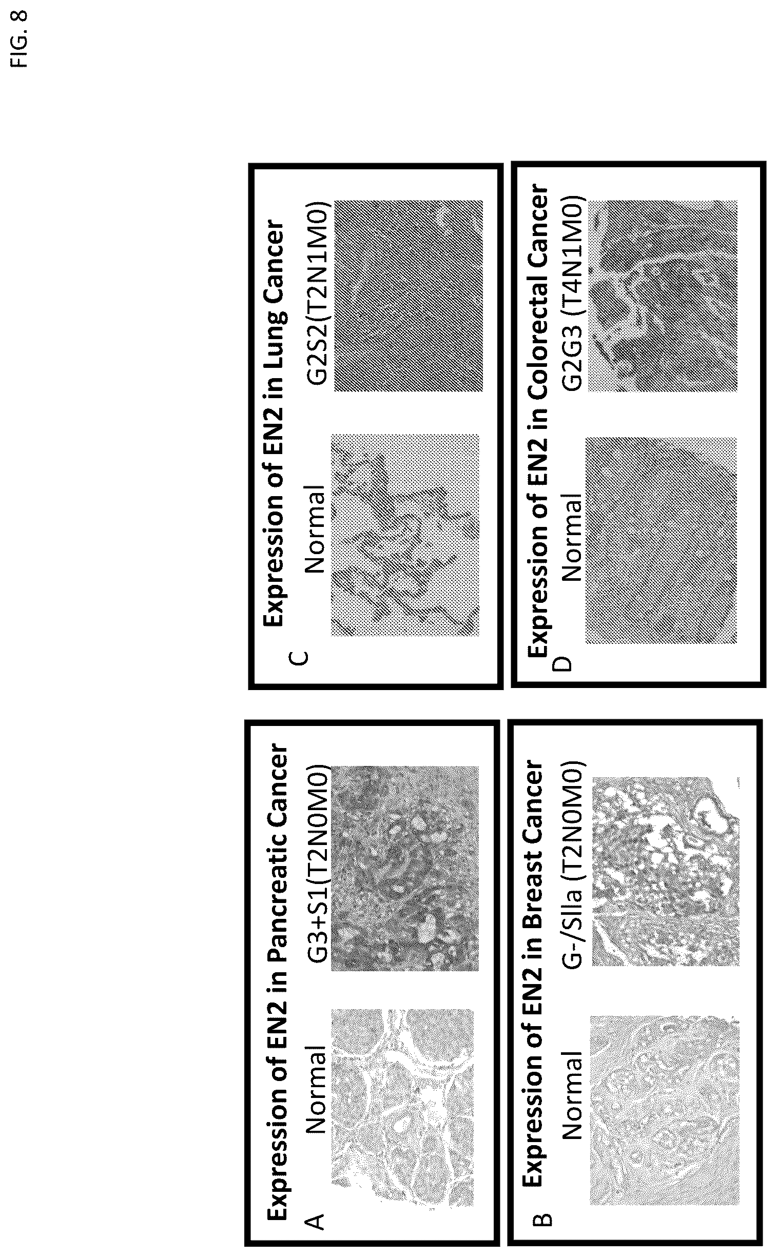 Patent US12303494 Figure 8 – Compositions and methods for monitoring, diagnosis, prognosis, detection, and treatment of cancer
