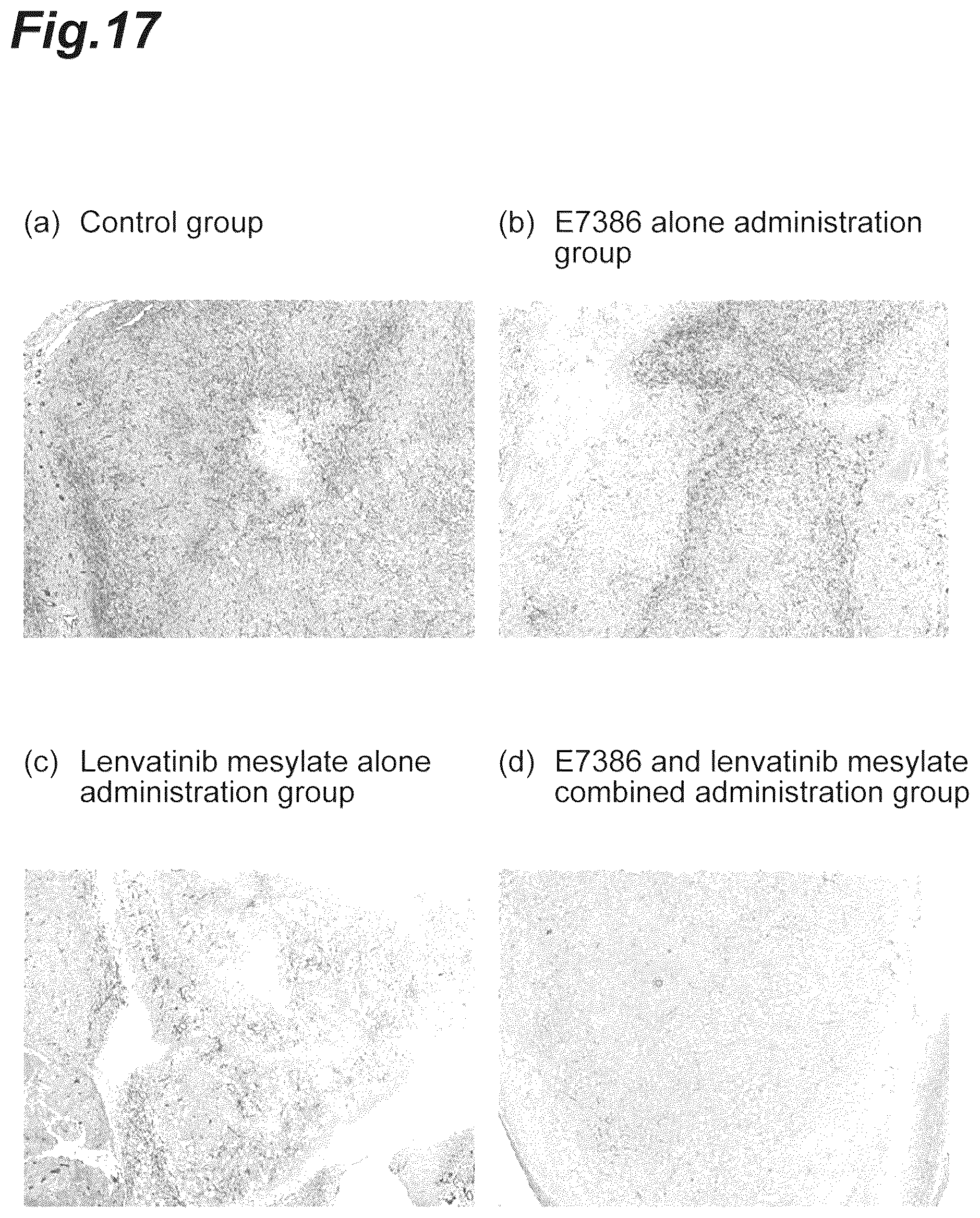Patent US12303505 Figure 17 – Tumor-treating pharmaceutical composition