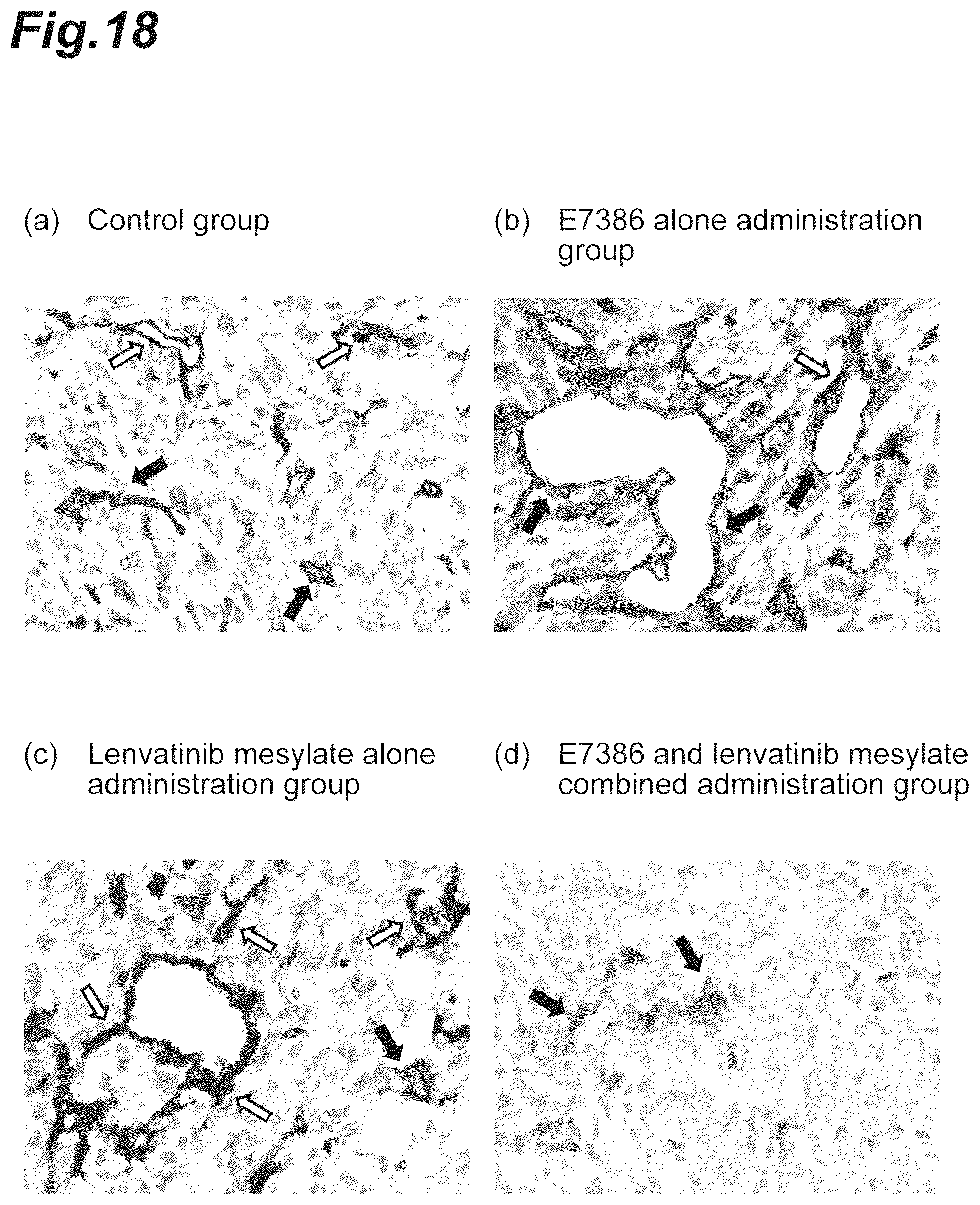 Patent US12303505 Figure 18 – Tumor-treating pharmaceutical composition