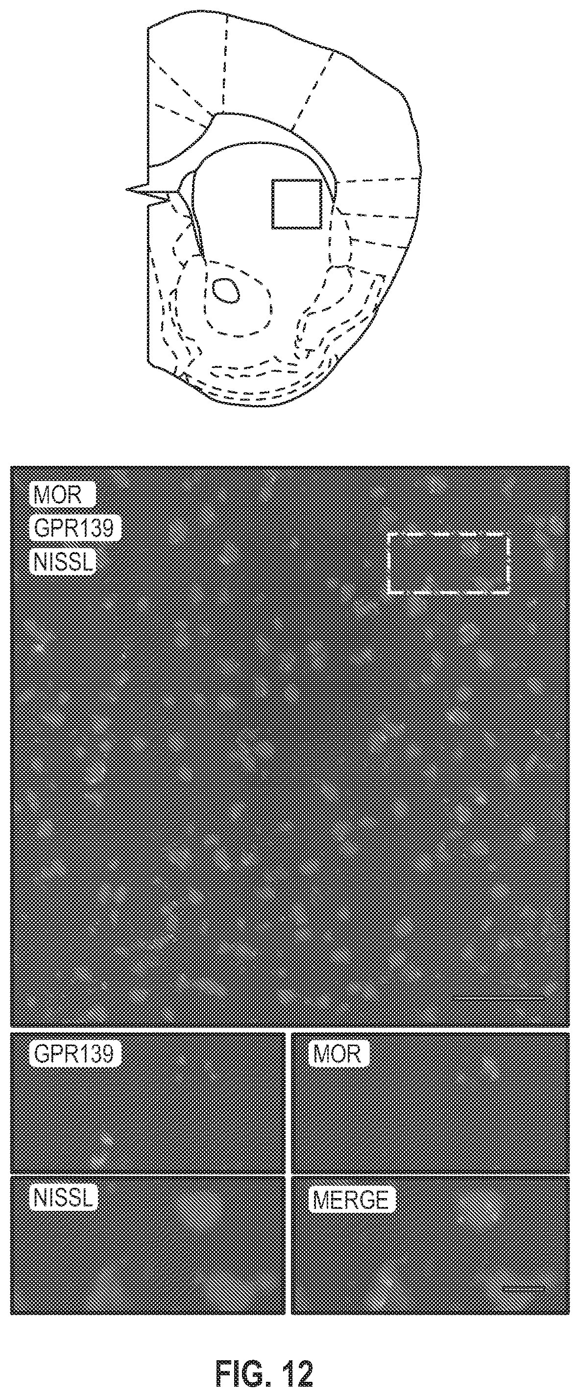 Patent US12303511 Figure 12 – Methods related to opioid therapeutics