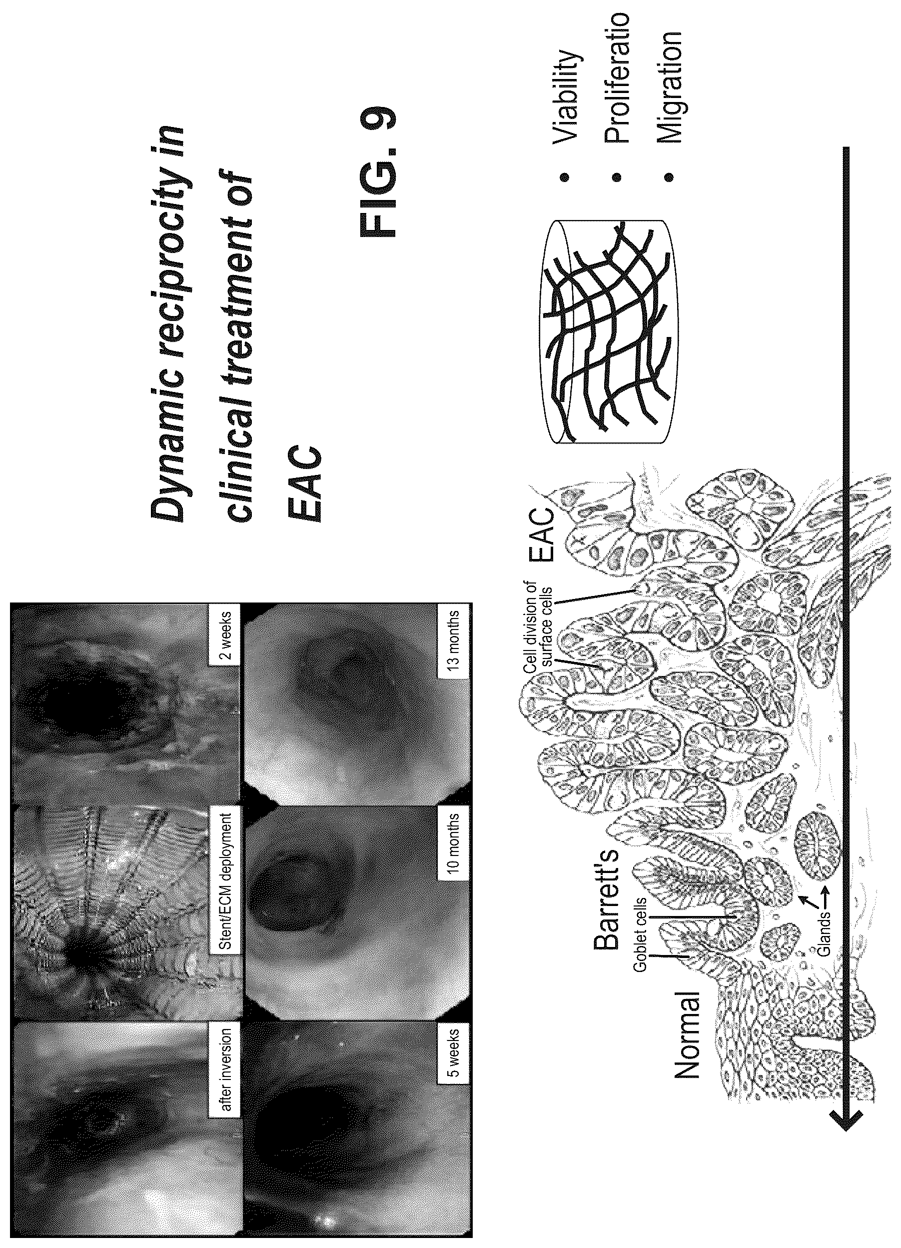 Patent US12303533 Figure 10 – ECM hydrogel for treating esophageal inflammation