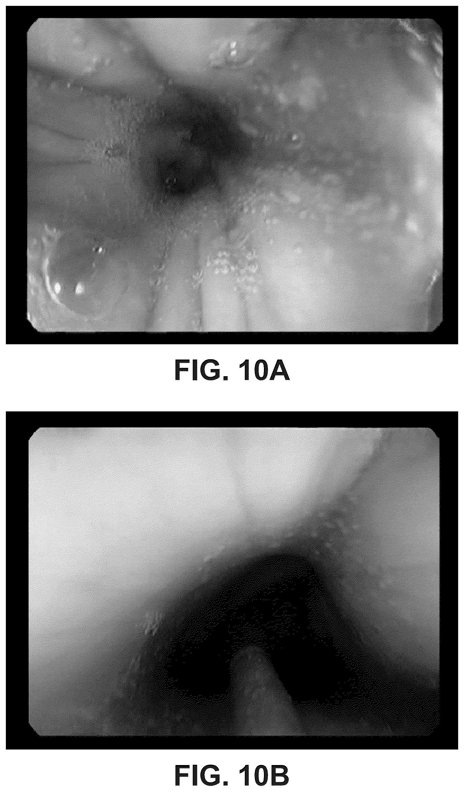 Patent US12303533 Figure 11 – ECM hydrogel for treating esophageal inflammation