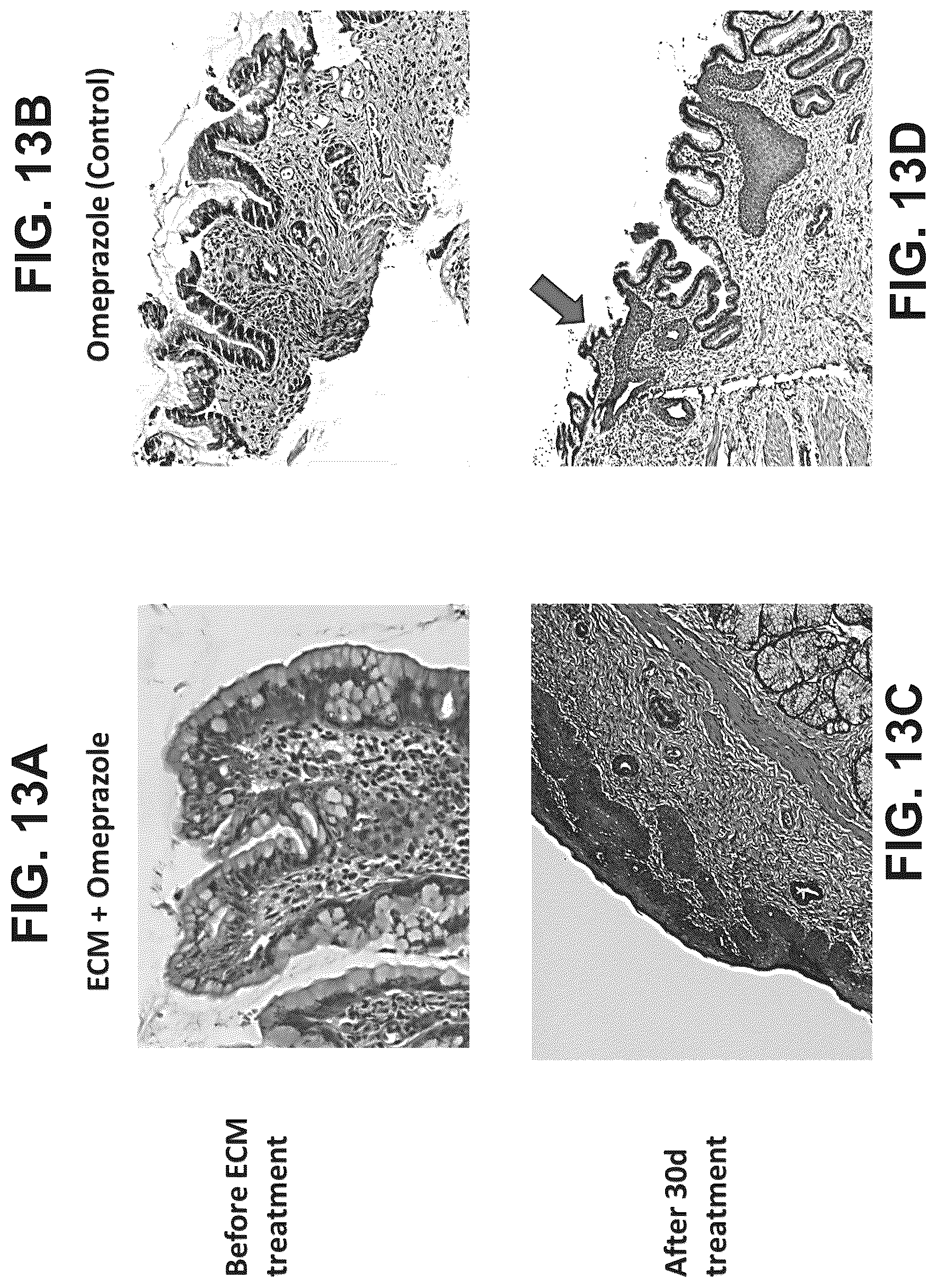 Patent US12303533 Figure 15 – ECM hydrogel for treating esophageal inflammation