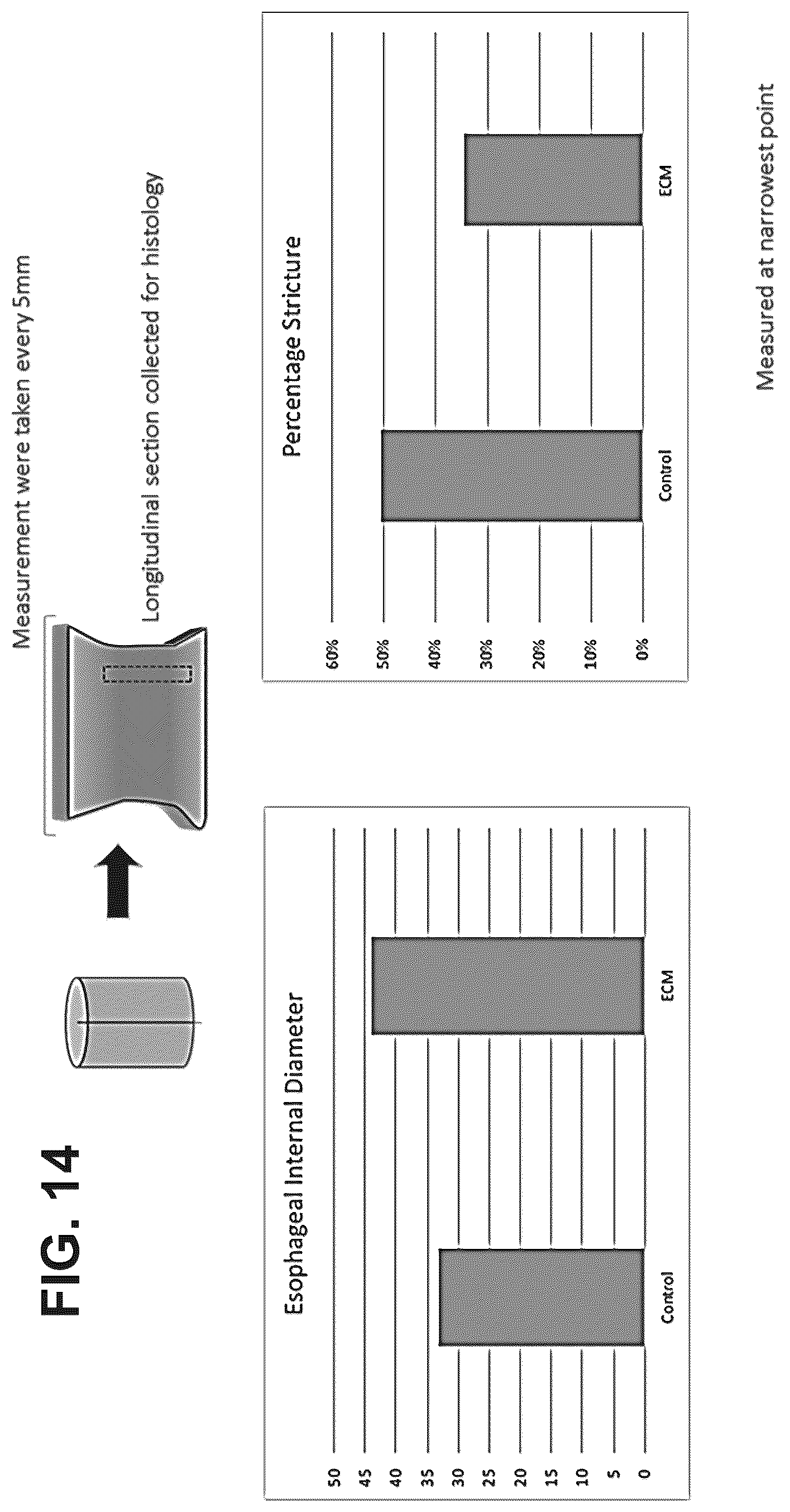Patent US12303533 Figure 16 – ECM hydrogel for treating esophageal inflammation