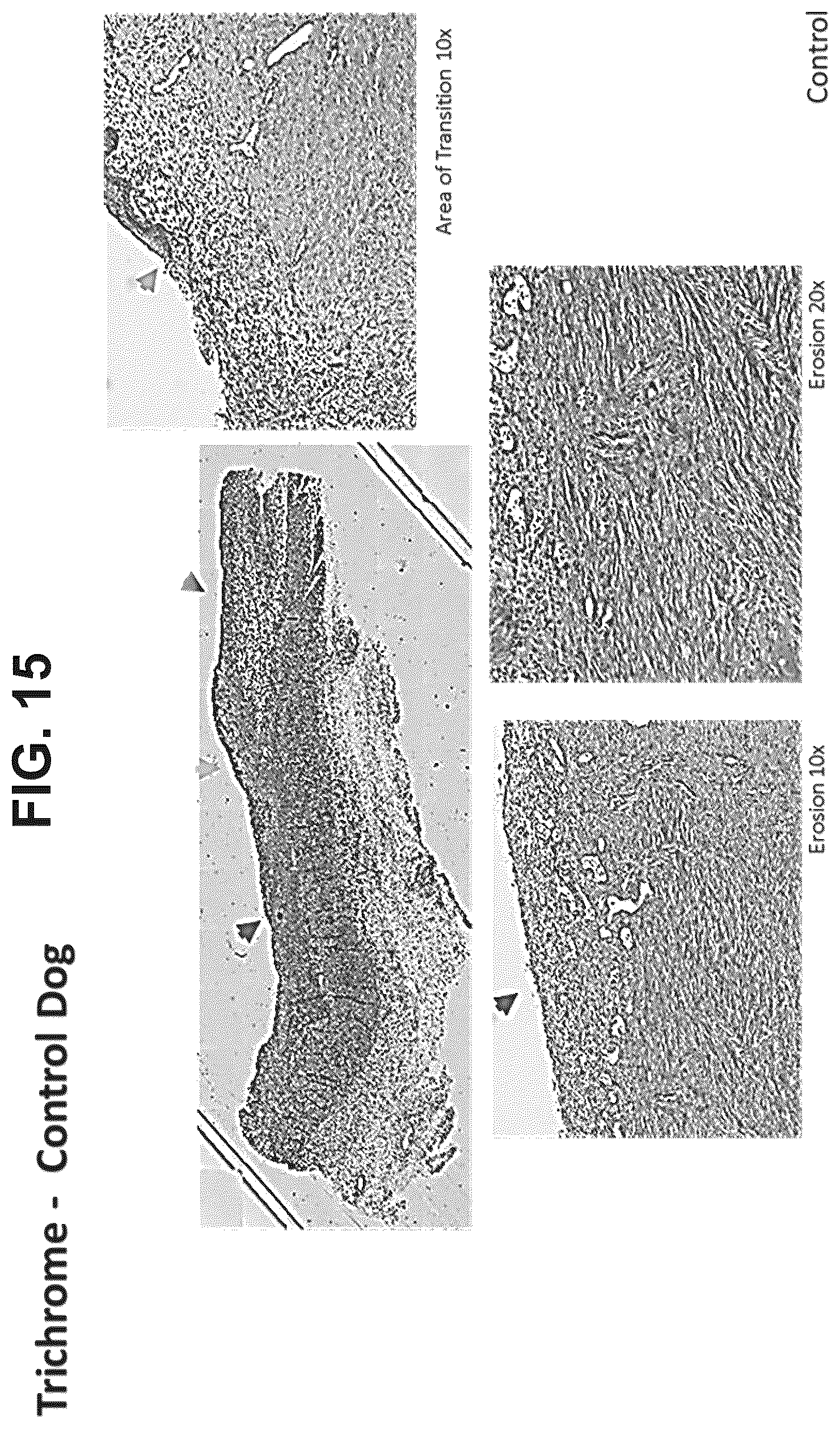 Patent US12303533 Figure 17 – ECM hydrogel for treating esophageal inflammation