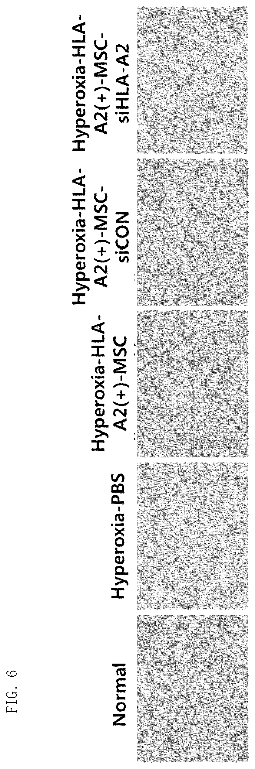 Patent US12303534 Figure 6 – Pharmaceutical composition comprising mesenchymal stem cells as effective ingredient for prevention or treatment of inflammatory disease