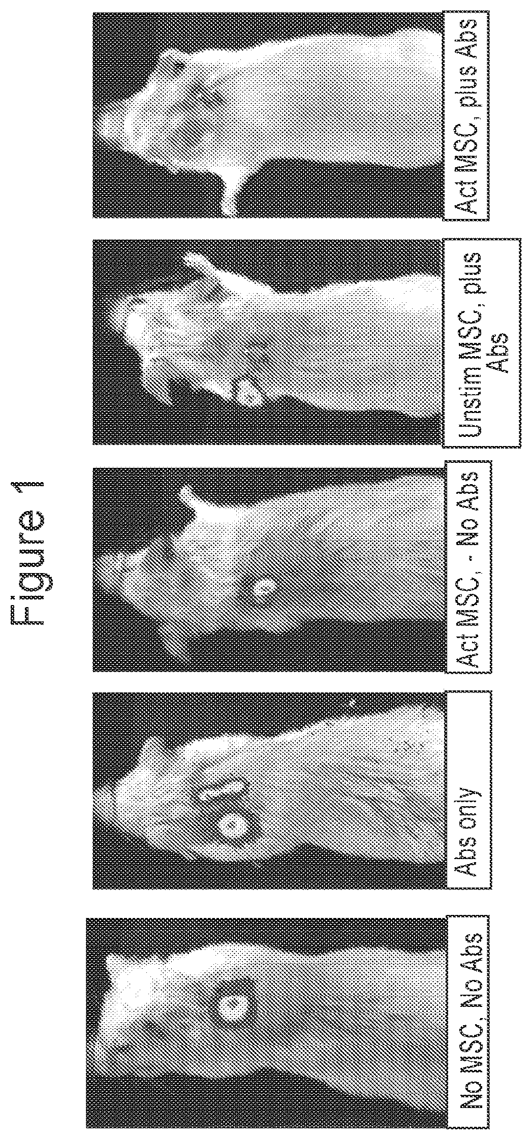 Patent US12303535 Figure 1 – Activated stem cells and systemic treatment methods for infected wounds