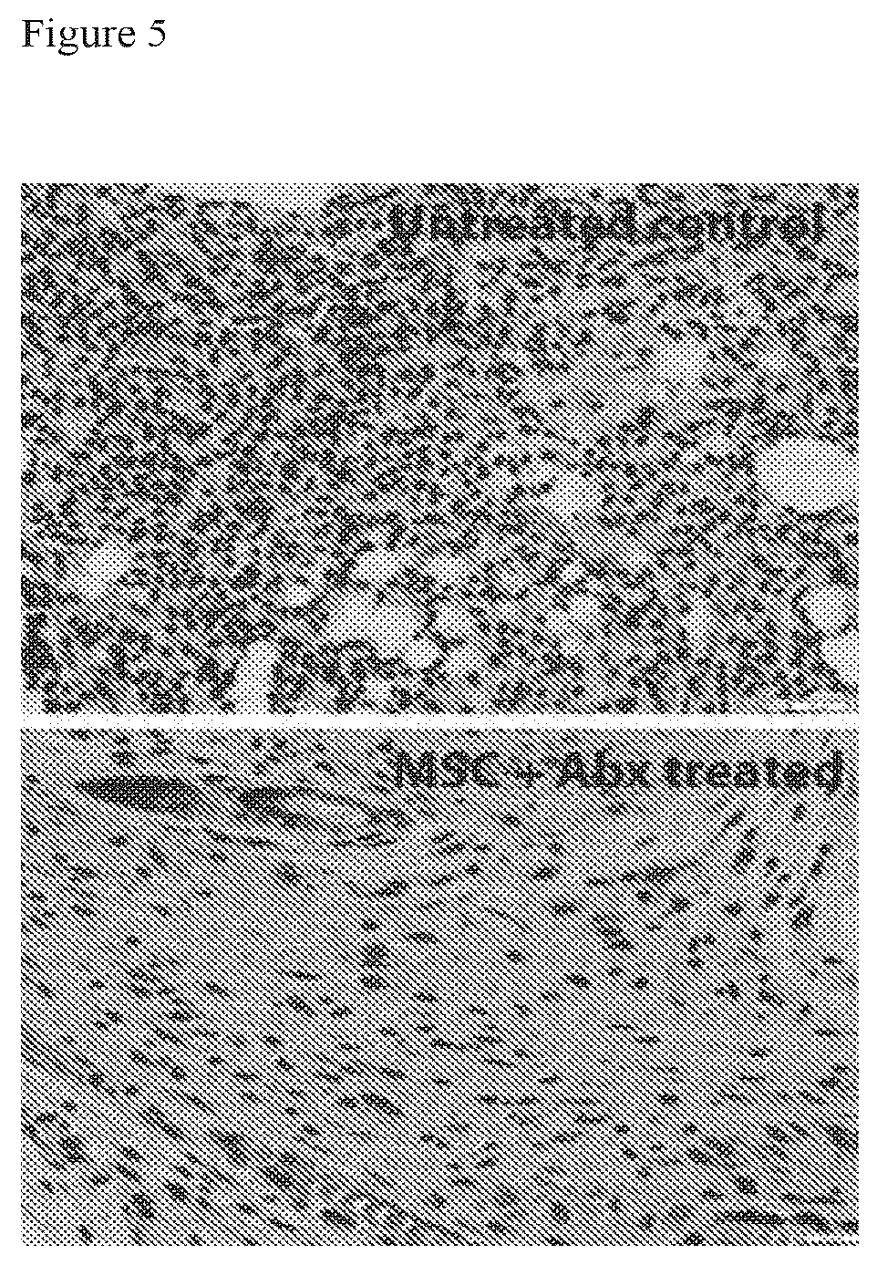 Patent US12303535 Figure 5 – Activated stem cells and systemic treatment methods for infected wounds