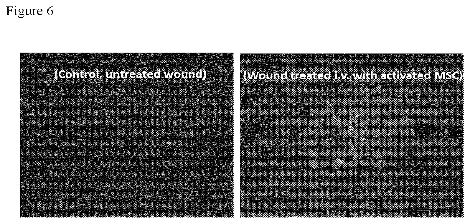 Patent US12303535 Figure 6 – Activated stem cells and systemic treatment methods for infected wounds