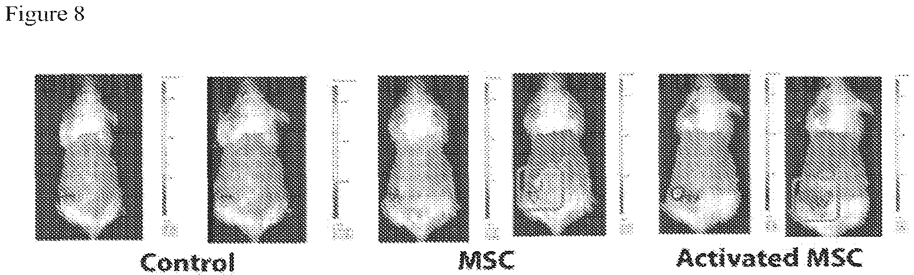 Patent US12303535 Figure 8 – Activated stem cells and systemic treatment methods for infected wounds