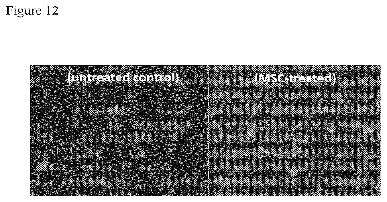 Patent US12303535 Figure 12 – Activated stem cells and systemic treatment methods for infected wounds