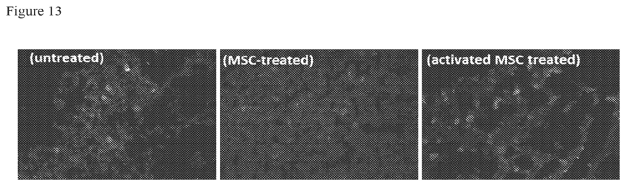 Patent US12303535 Figure 13 – Activated stem cells and systemic treatment methods for infected wounds