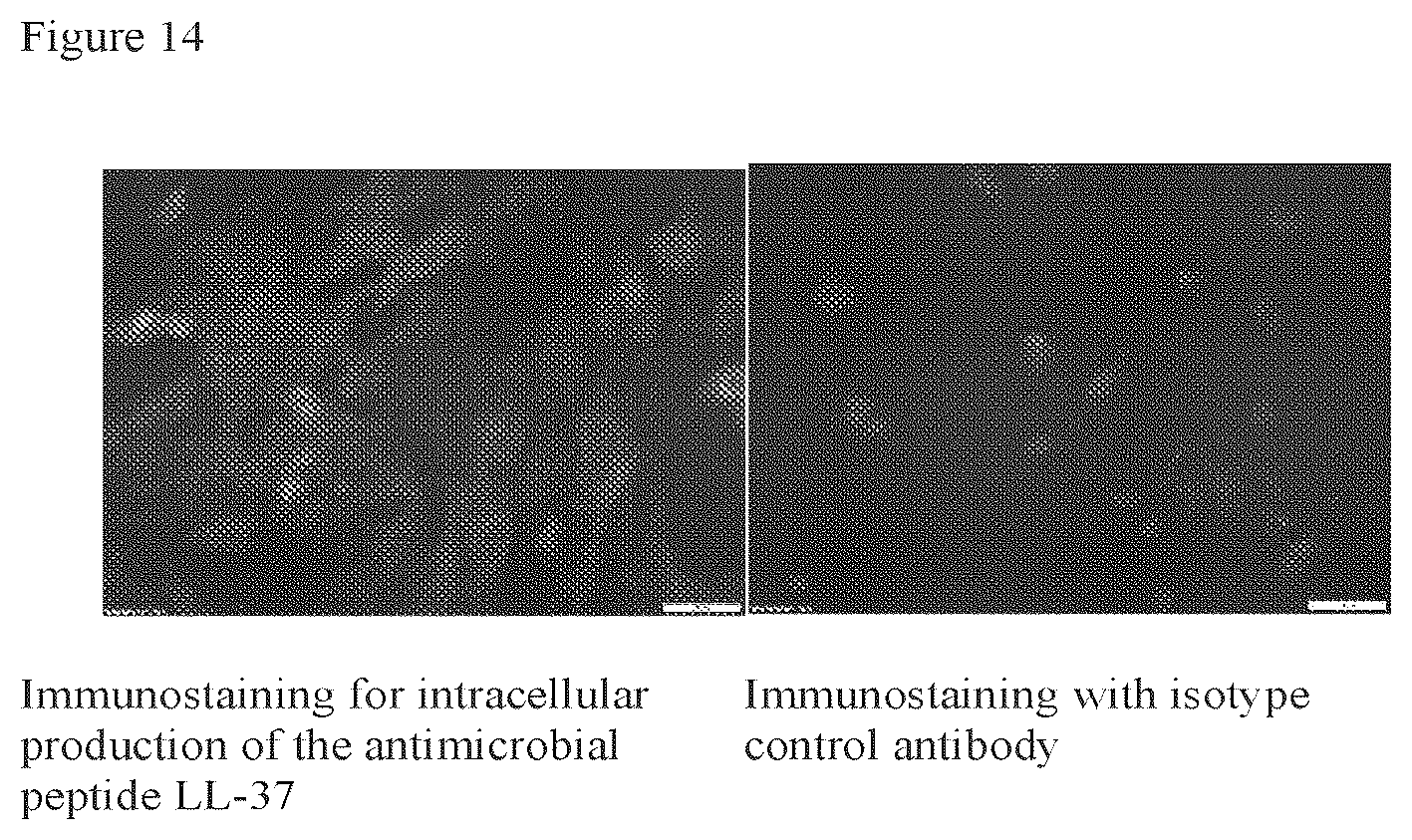Patent US12303535 Figure 14 – Activated stem cells and systemic treatment methods for infected wounds