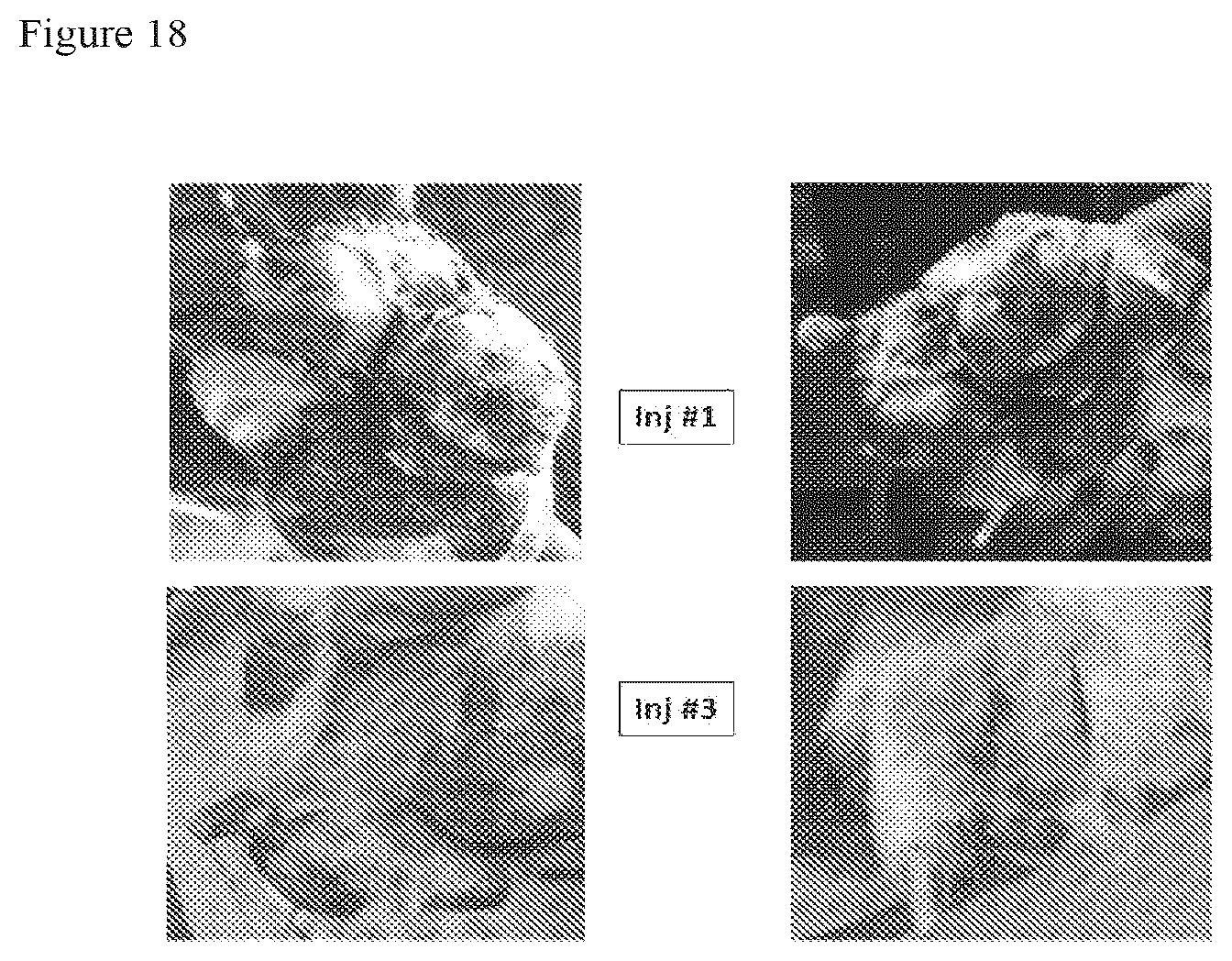 Patent US12303535 Figure 18 – Activated stem cells and systemic treatment methods for infected wounds