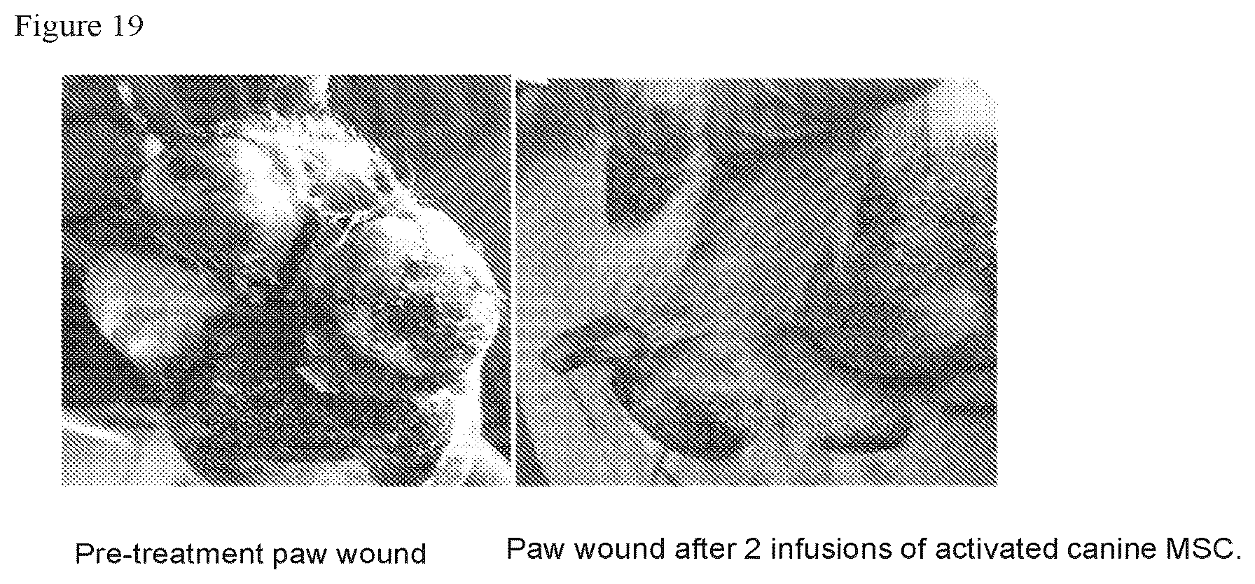 Patent US12303535 Figure 19 – Activated stem cells and systemic treatment methods for infected wounds