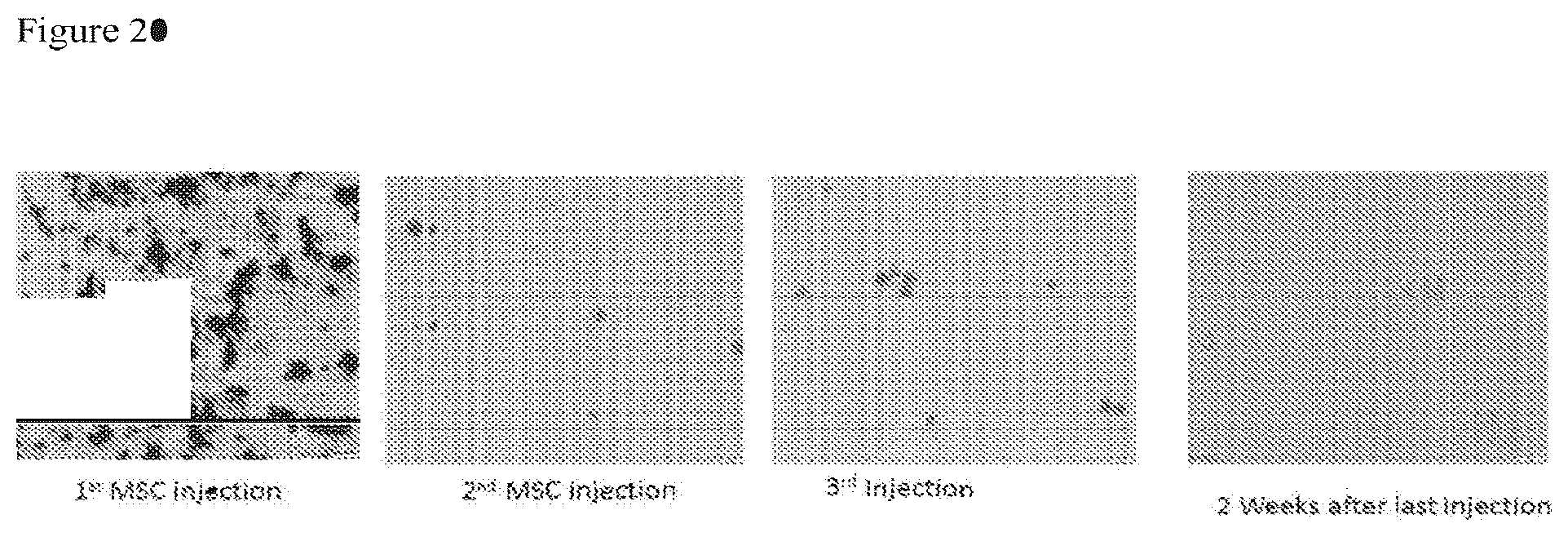 Patent US12303535 Figure 20 – Activated stem cells and systemic treatment methods for infected wounds