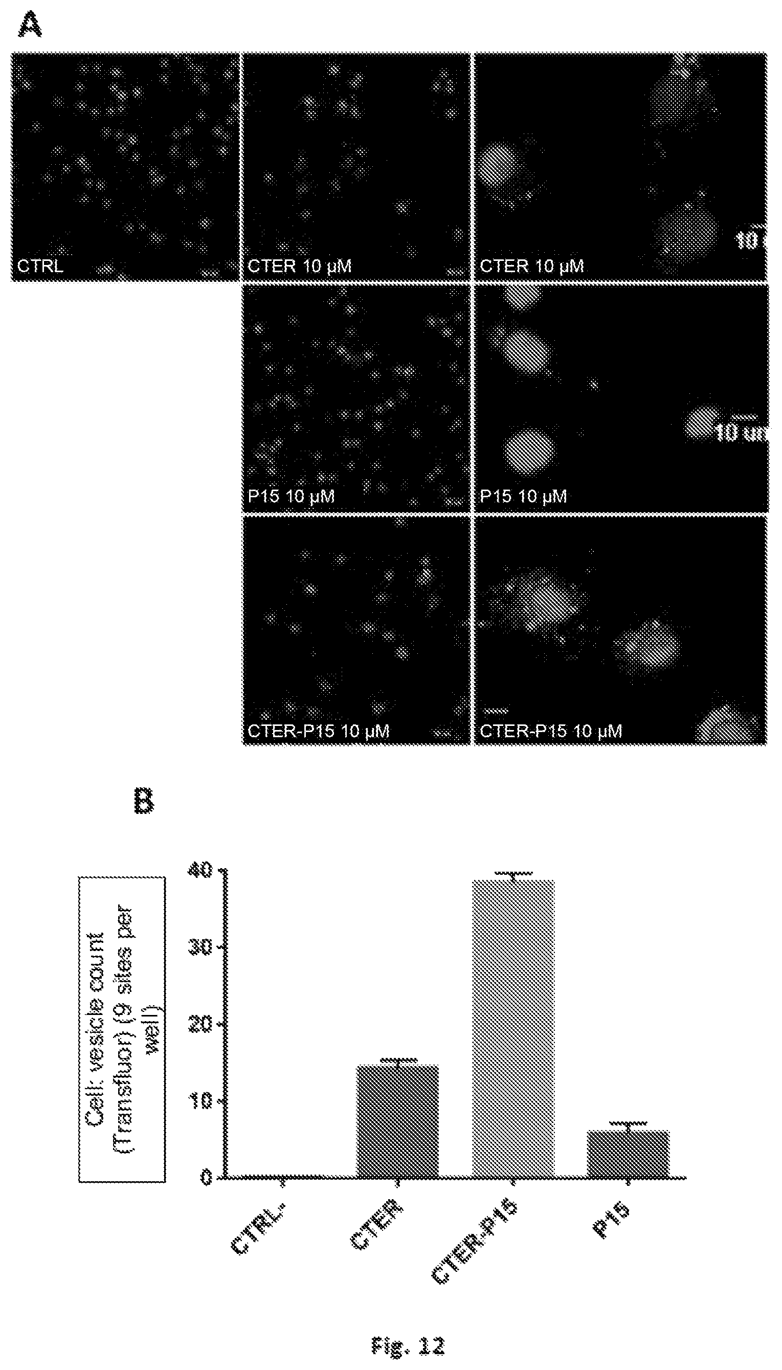 Patent US12303547 Figure 12 – Compound, use, pharmaceutical composition, method of diagnosis, method of treatment, and method of transportation and/or internalization of a compound into eukaryotic cells