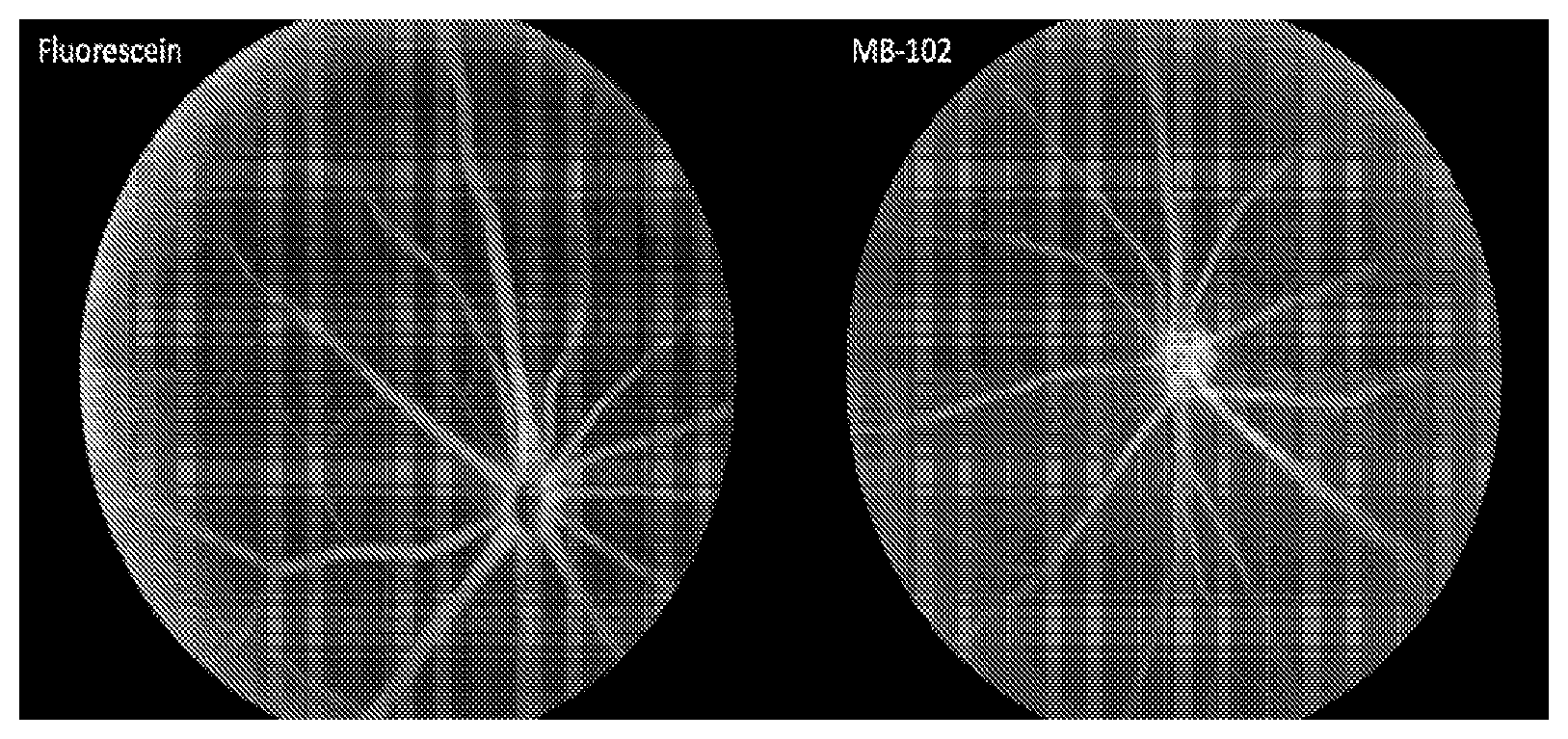 Patent US12303570 Figure 1 – Compositions and methods for assessing eye vasculature
