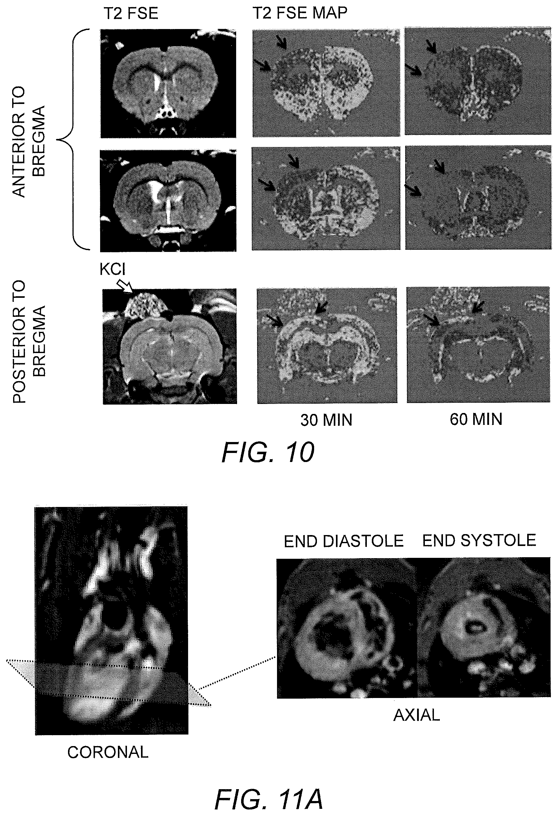 Patent US12303572 Figure 8 – Ascorbate formulations and methods of use as contrast agents