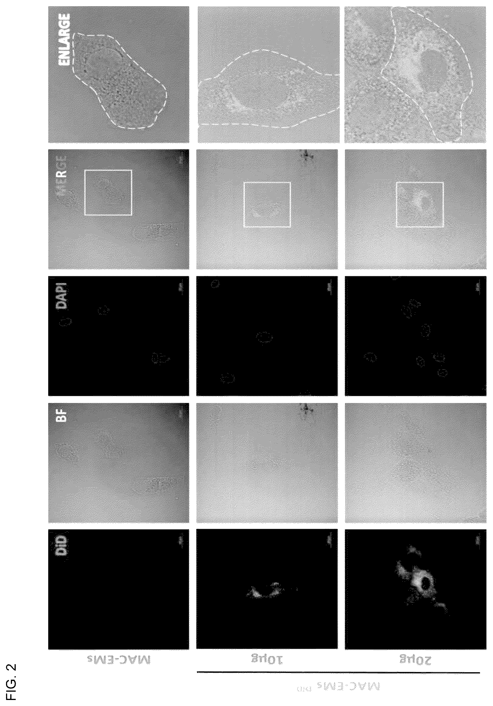 Patent US12303589 Figure 2 – Composition for hair regeneration comprising macrophage-derived extracellular vesicle mimetics