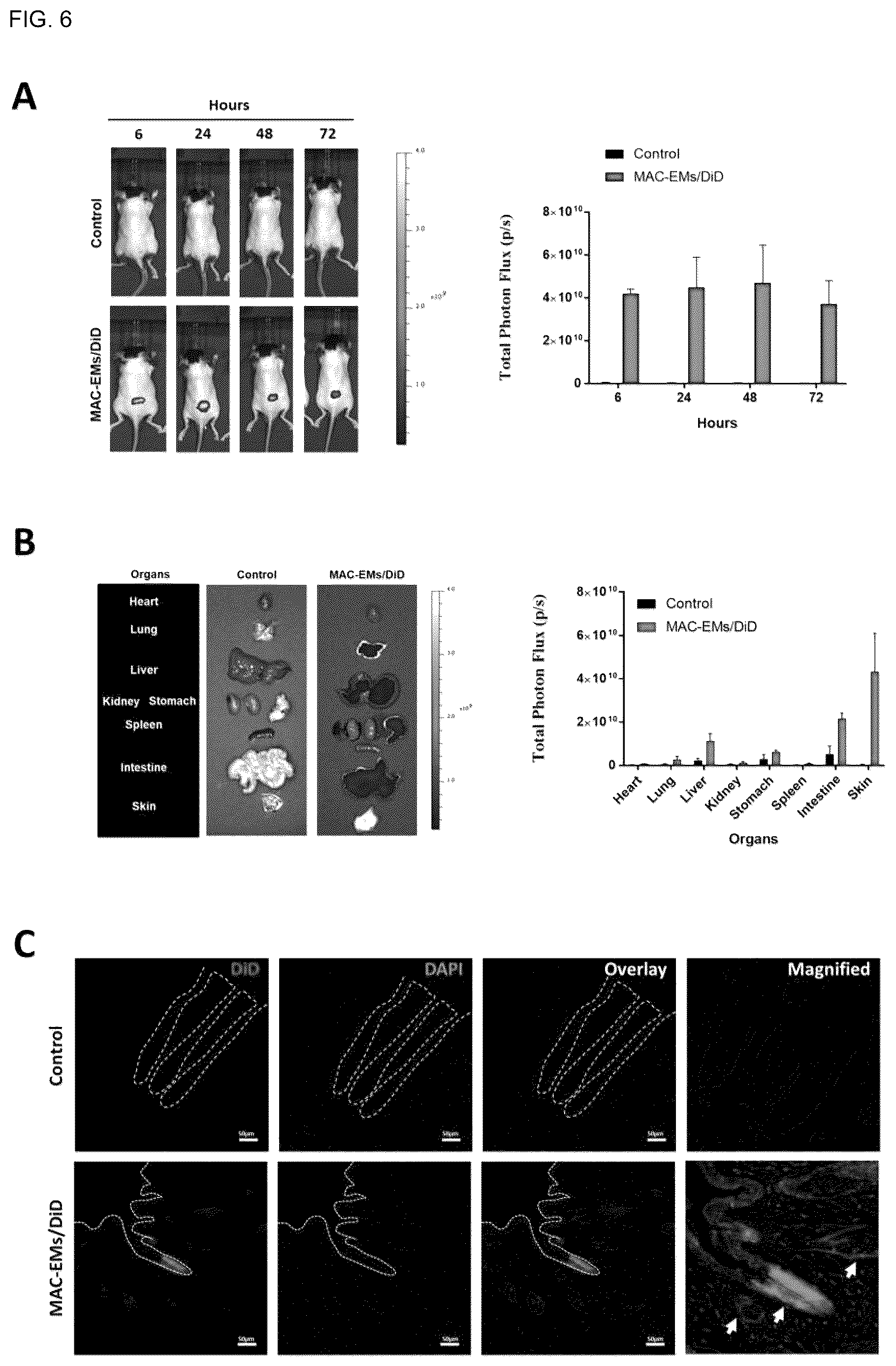 Patent US12303589 Figure 5 – Composition for hair regeneration comprising macrophage-derived extracellular vesicle mimetics