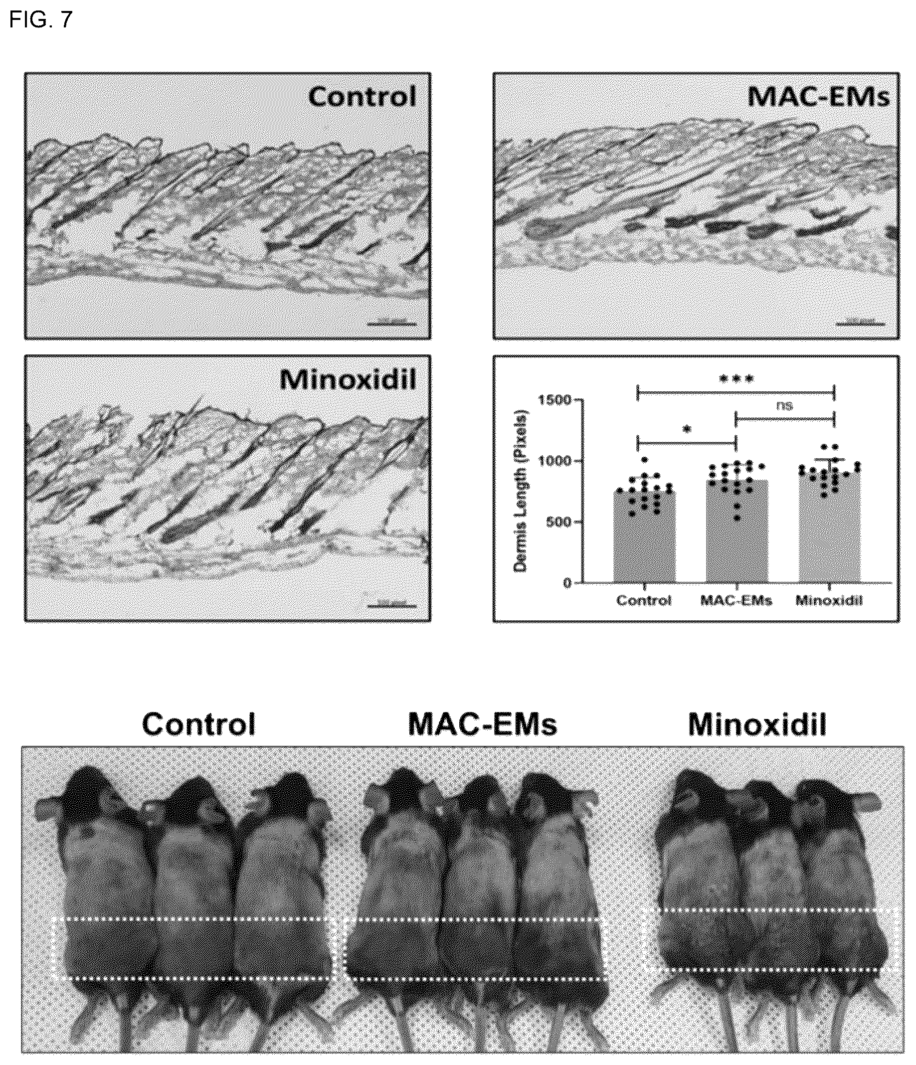 Patent US12303589 Figure 6 – Composition for hair regeneration comprising macrophage-derived extracellular vesicle mimetics