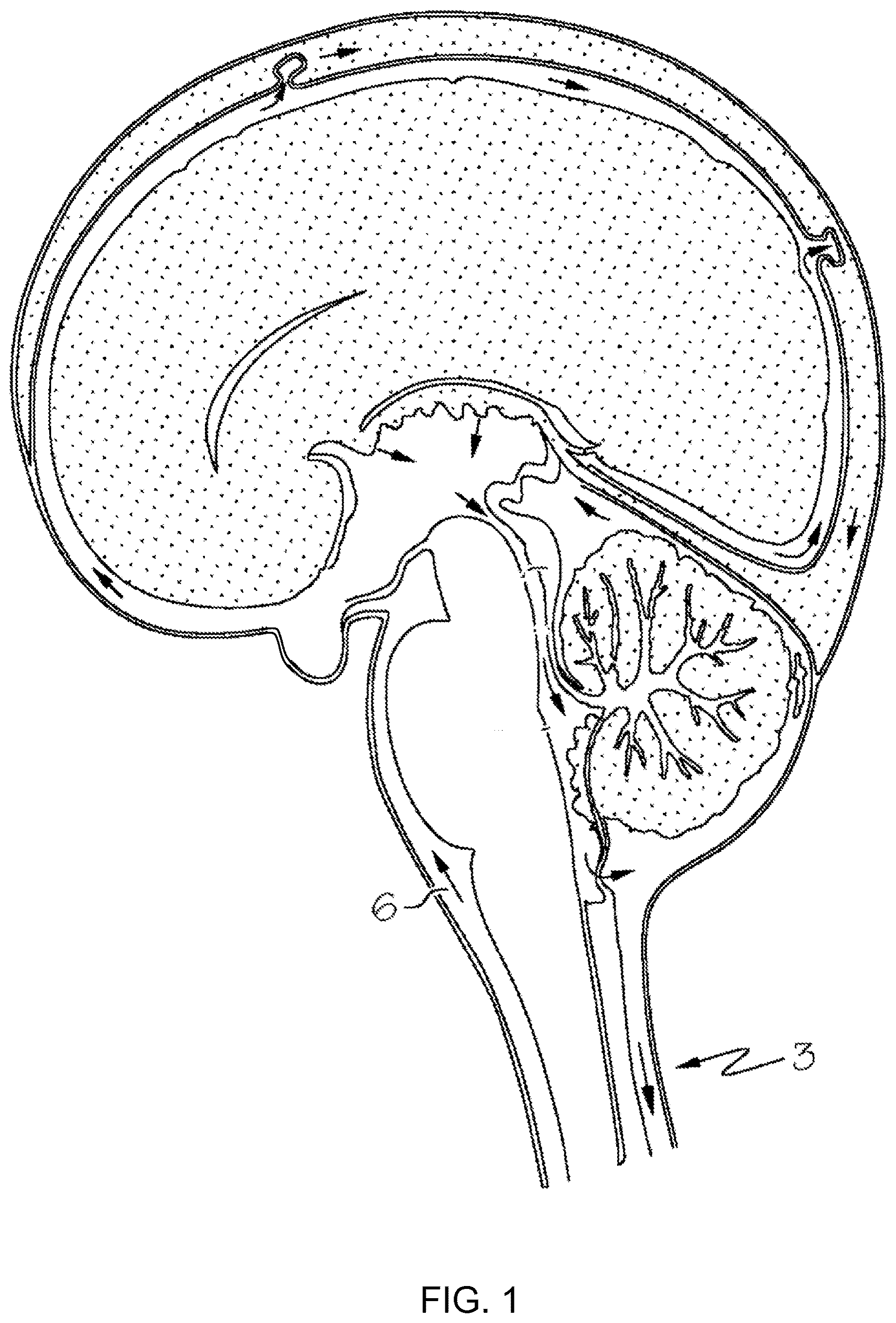 Patent US12303595 Figure 1 – Methods of administering anti-epilepsy agents and transport inhibitors to a subject