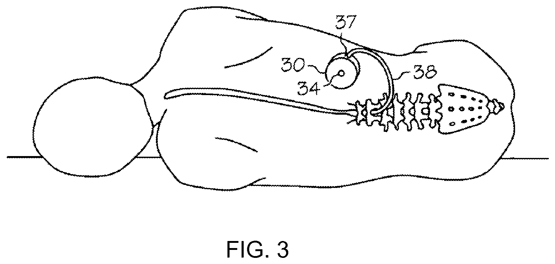 Patent US12303595 Figure 3 – Methods of administering anti-epilepsy agents and transport inhibitors to a subject
