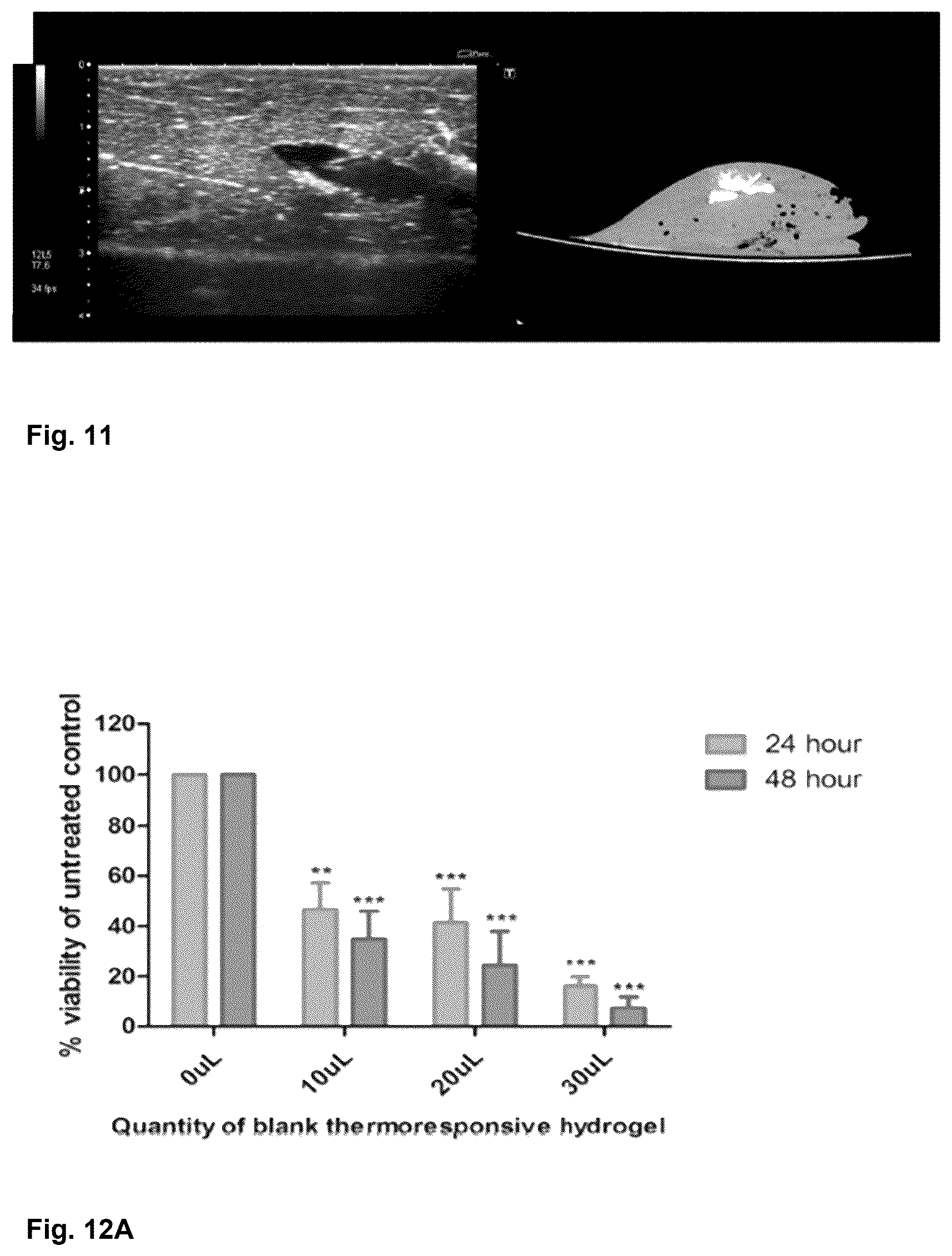 Patent US12303596 Figure 8 – Thermo-responsive hydrogel for intratumoral administration as a treatment in solid tumor cancers