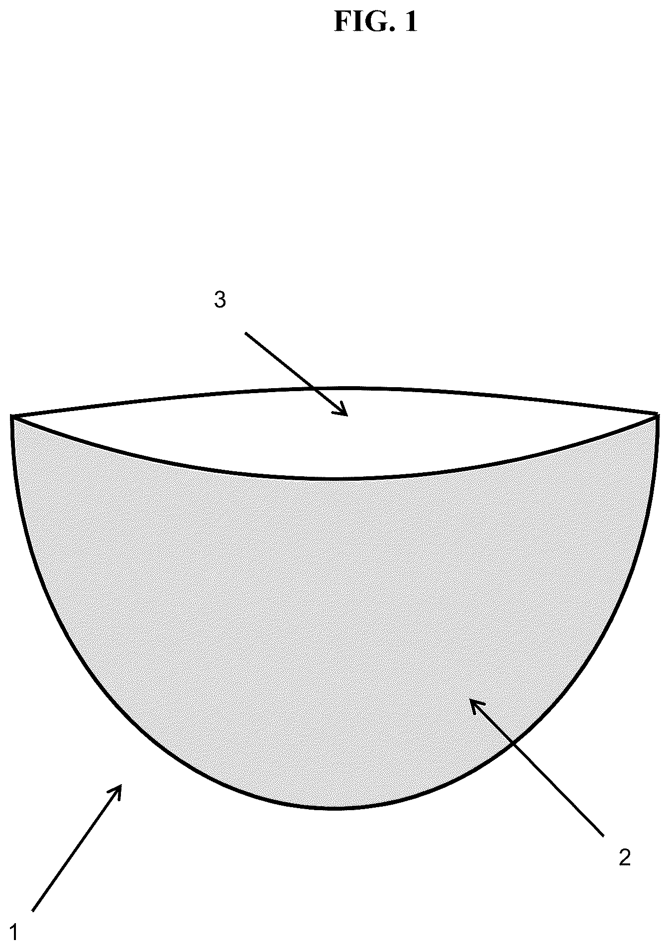 Patent US12303612 Figure 1 – Soft tissue implant pocket