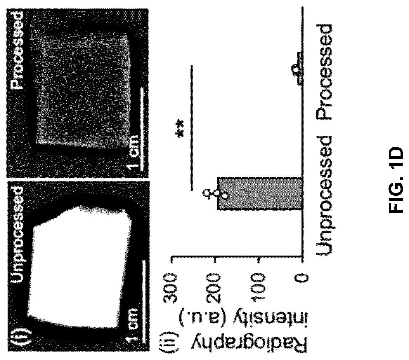 Patent US12303615 Figure 3 – Demineralized bone paper