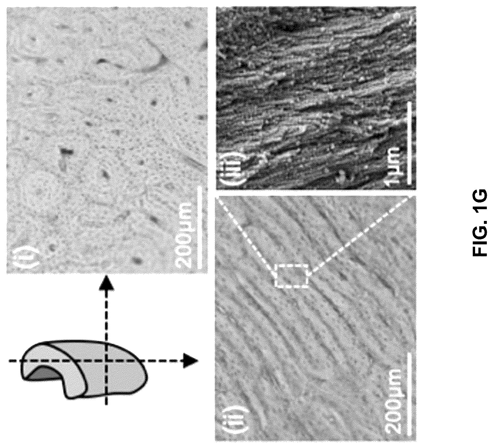 Patent US12303615 Figure 6 – Demineralized bone paper