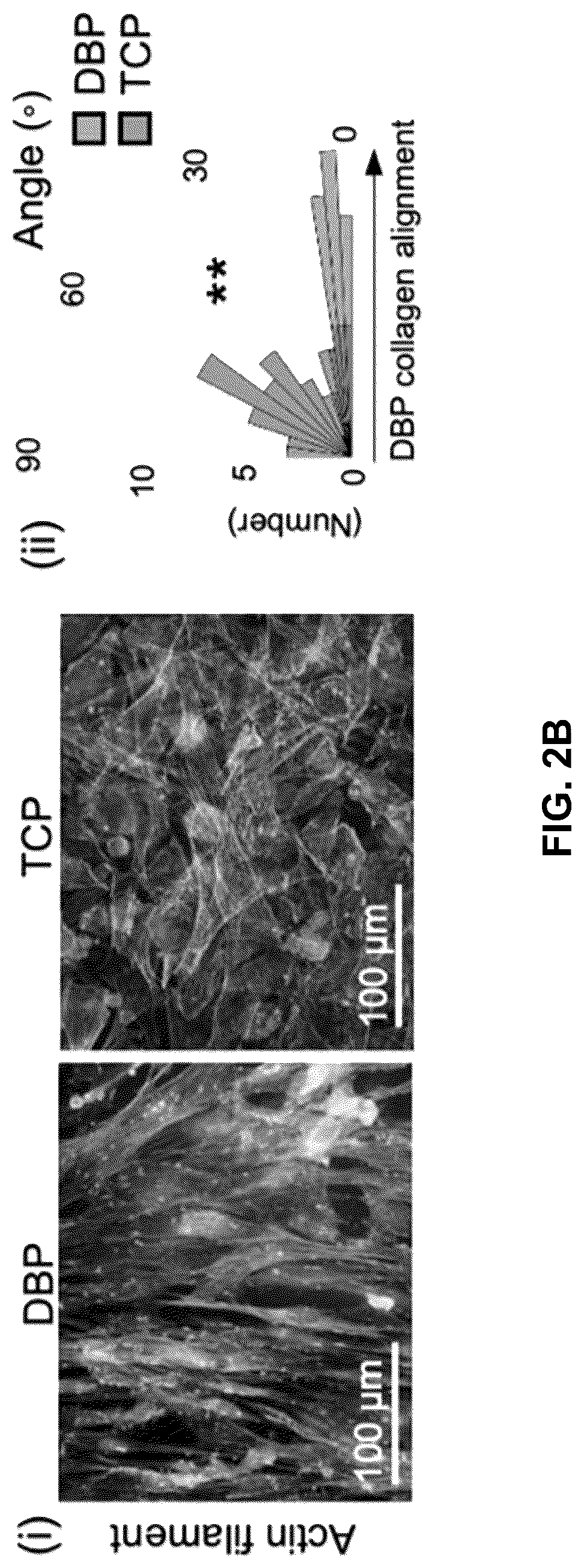 Patent US12303615 Figure 10 – Demineralized bone paper