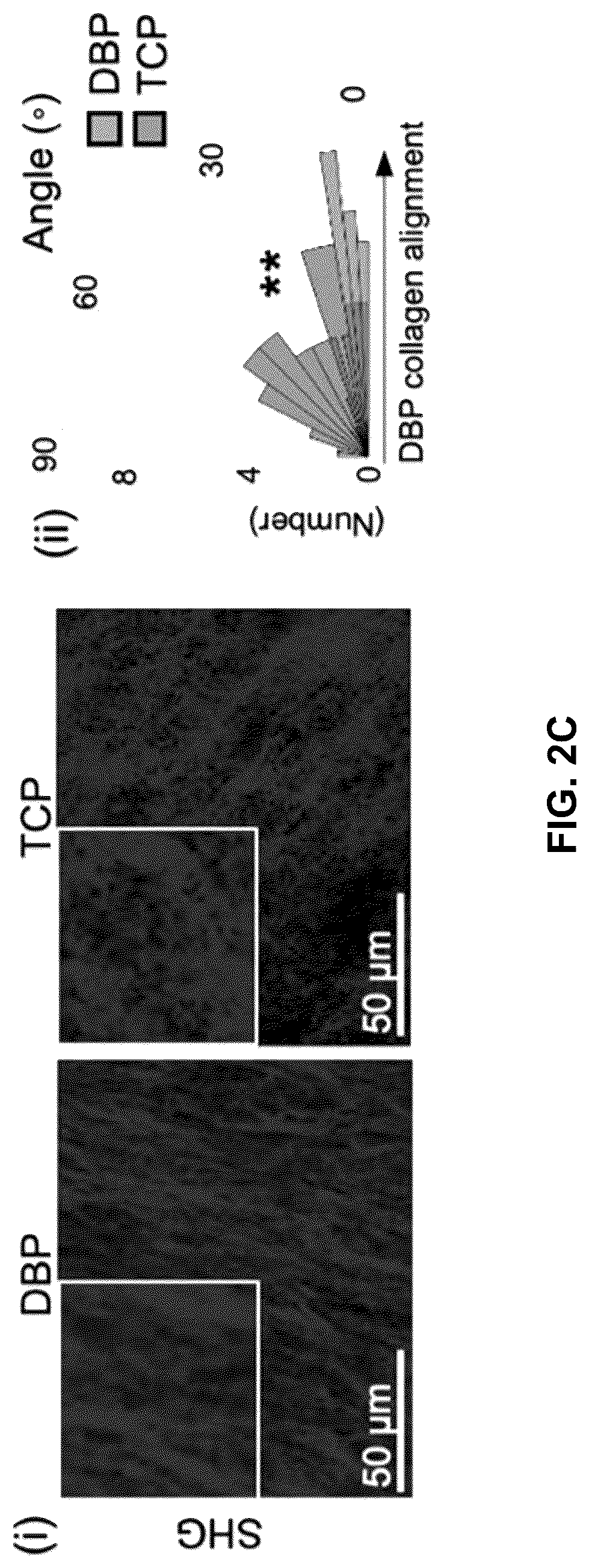Patent US12303615 Figure 11 – Demineralized bone paper