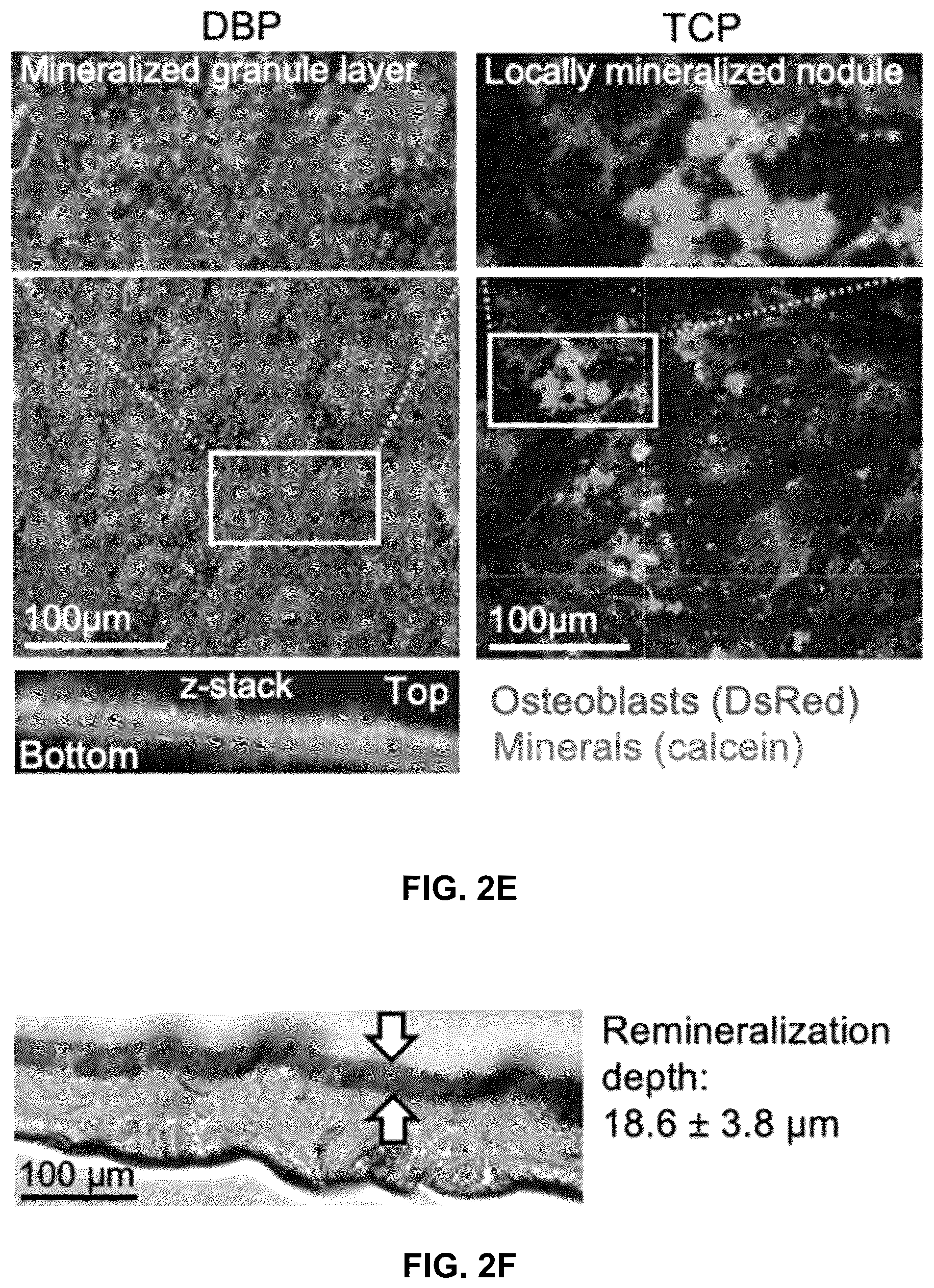 Patent US12303615 Figure 13 – Demineralized bone paper