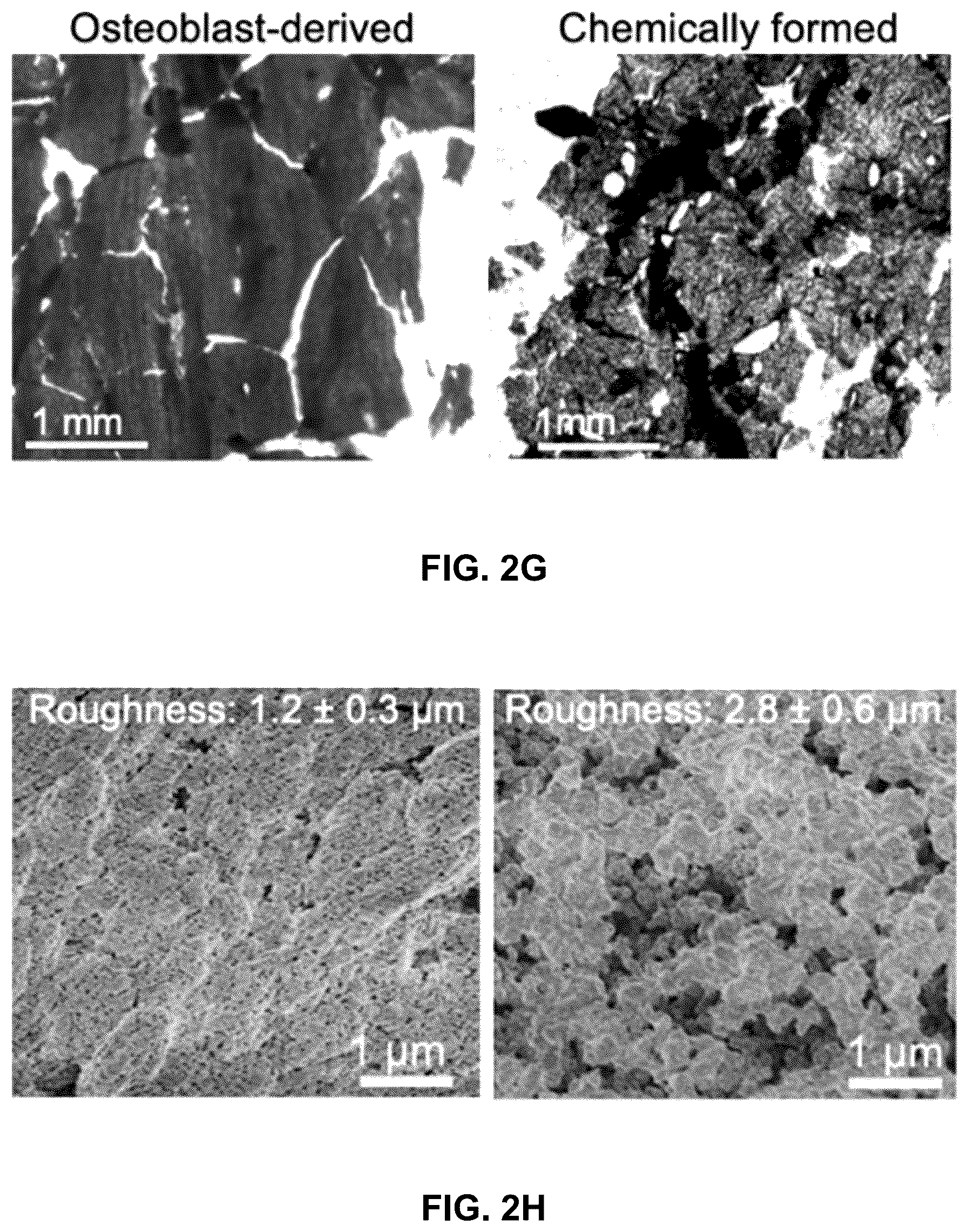 Patent US12303615 Figure 14 – Demineralized bone paper