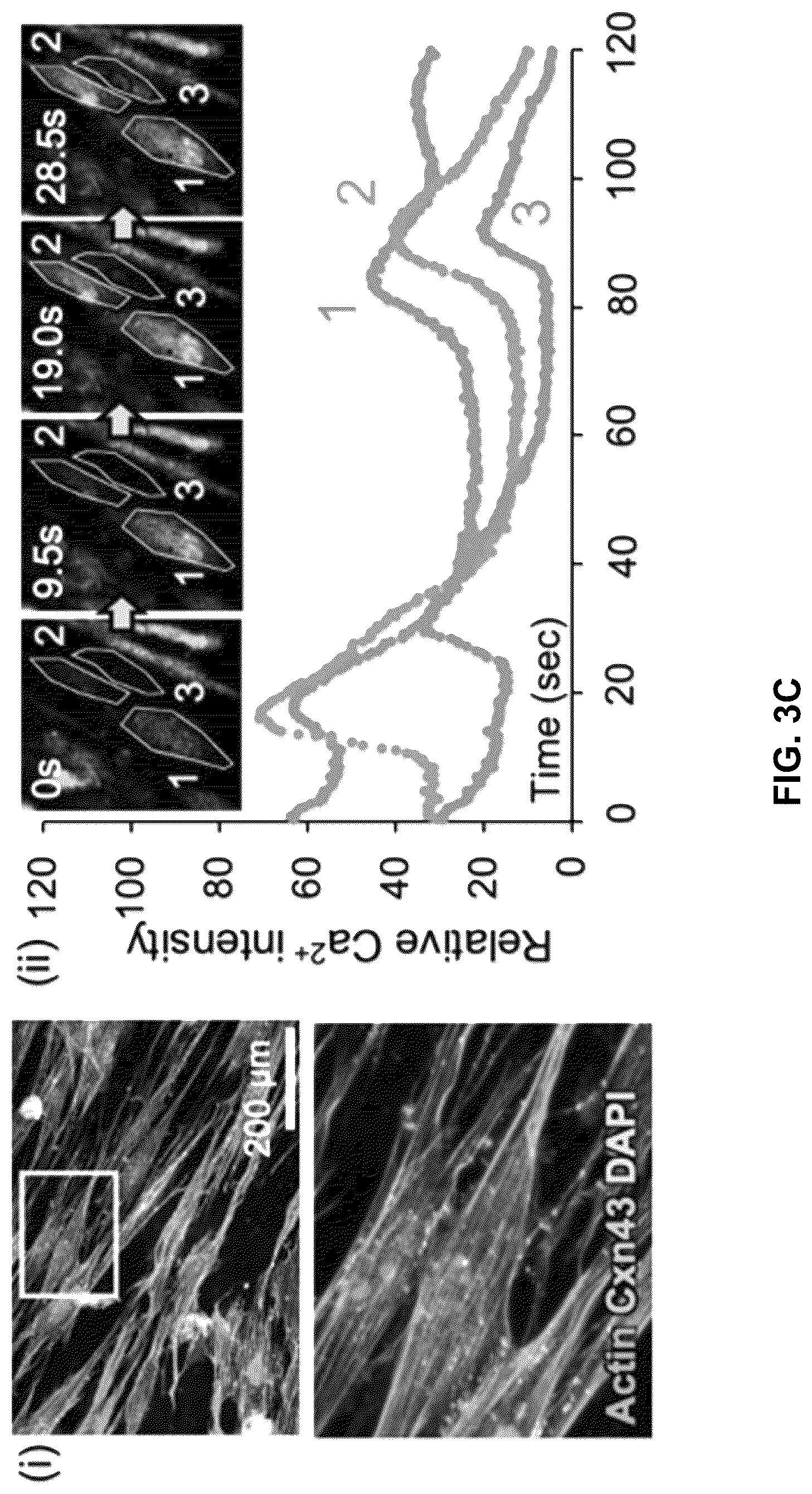 Patent US12303615 Figure 16 – Demineralized bone paper