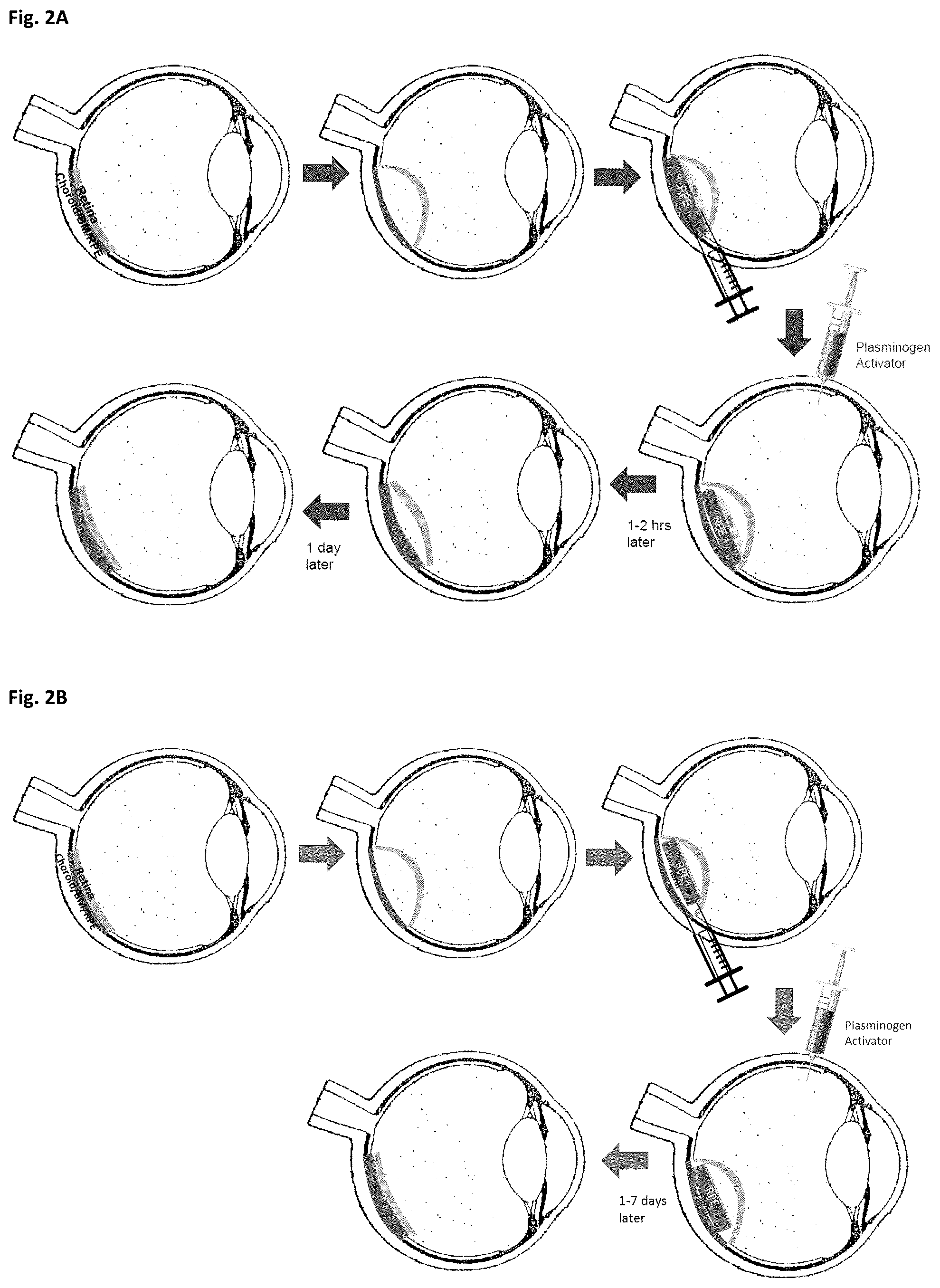 Patent US12303617 Figure 2 – Methods and materials for using fibrin supports for retinal pigment epithelium transplantation