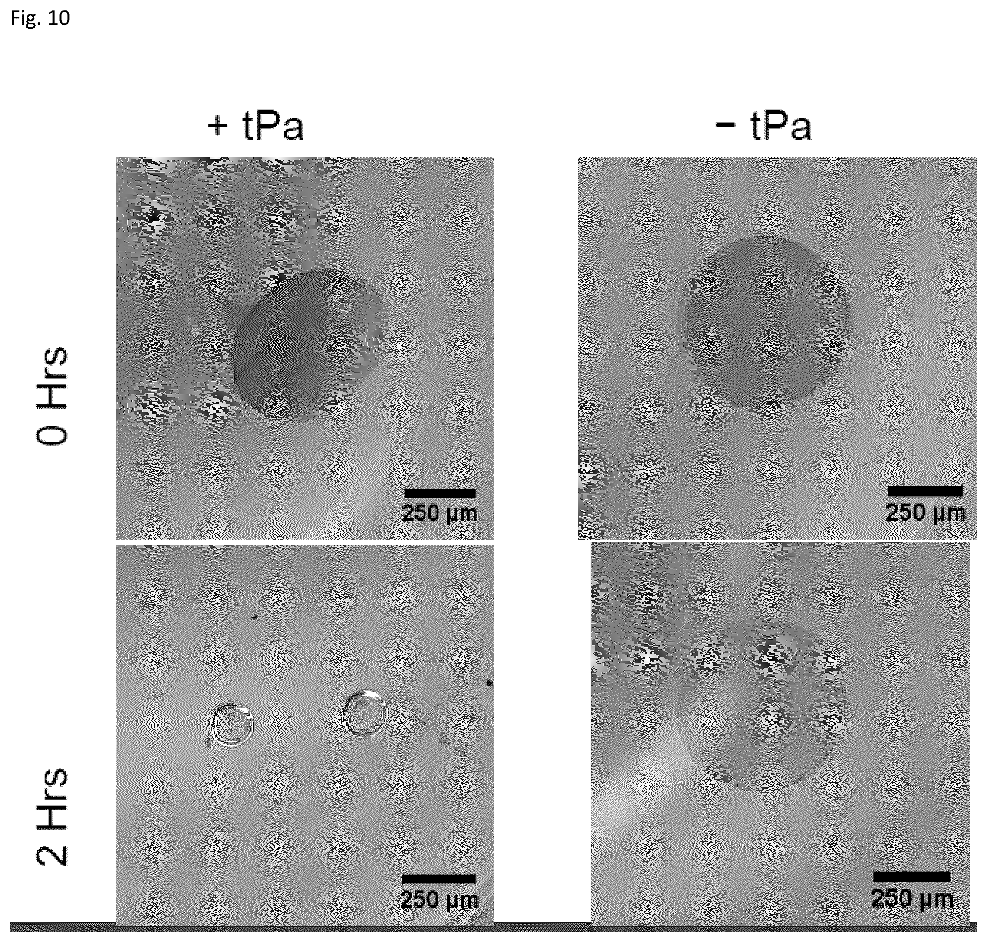 Patent US12303617 Figure 10 – Methods and materials for using fibrin supports for retinal pigment epithelium transplantation