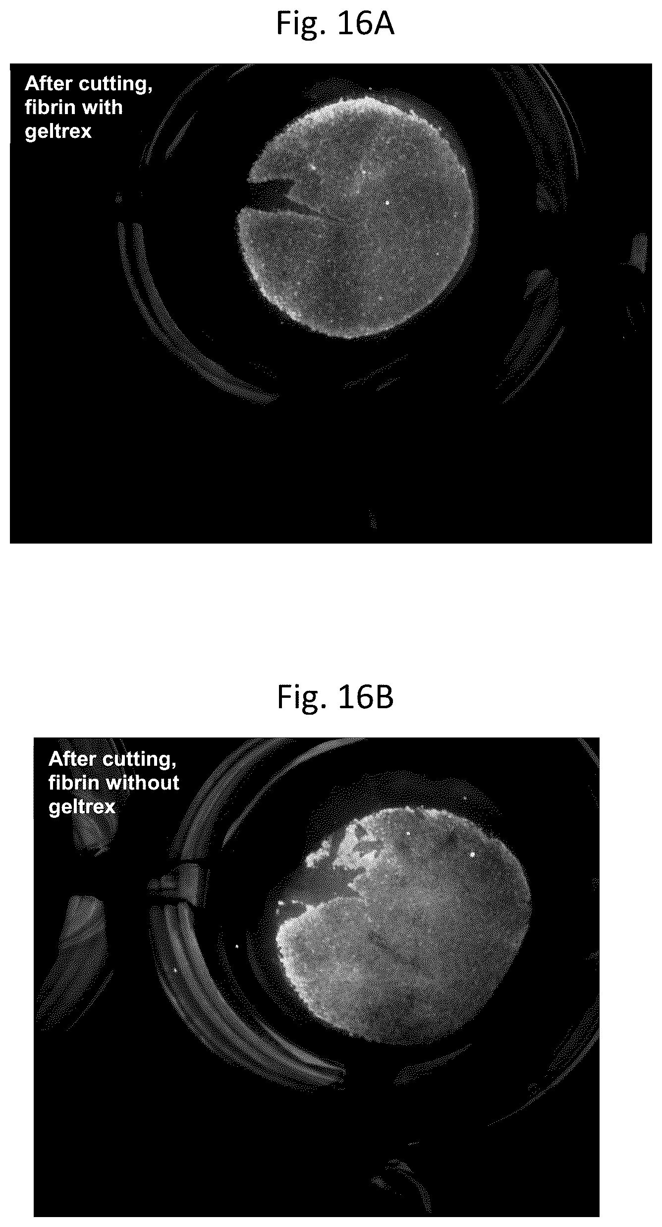 Patent US12303617 Figure 17 – Methods and materials for using fibrin supports for retinal pigment epithelium transplantation
