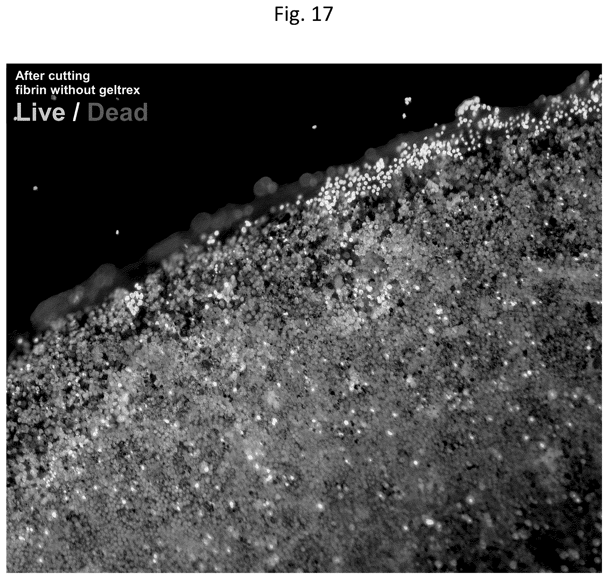Patent US12303617 Figure 18 – Methods and materials for using fibrin supports for retinal pigment epithelium transplantation