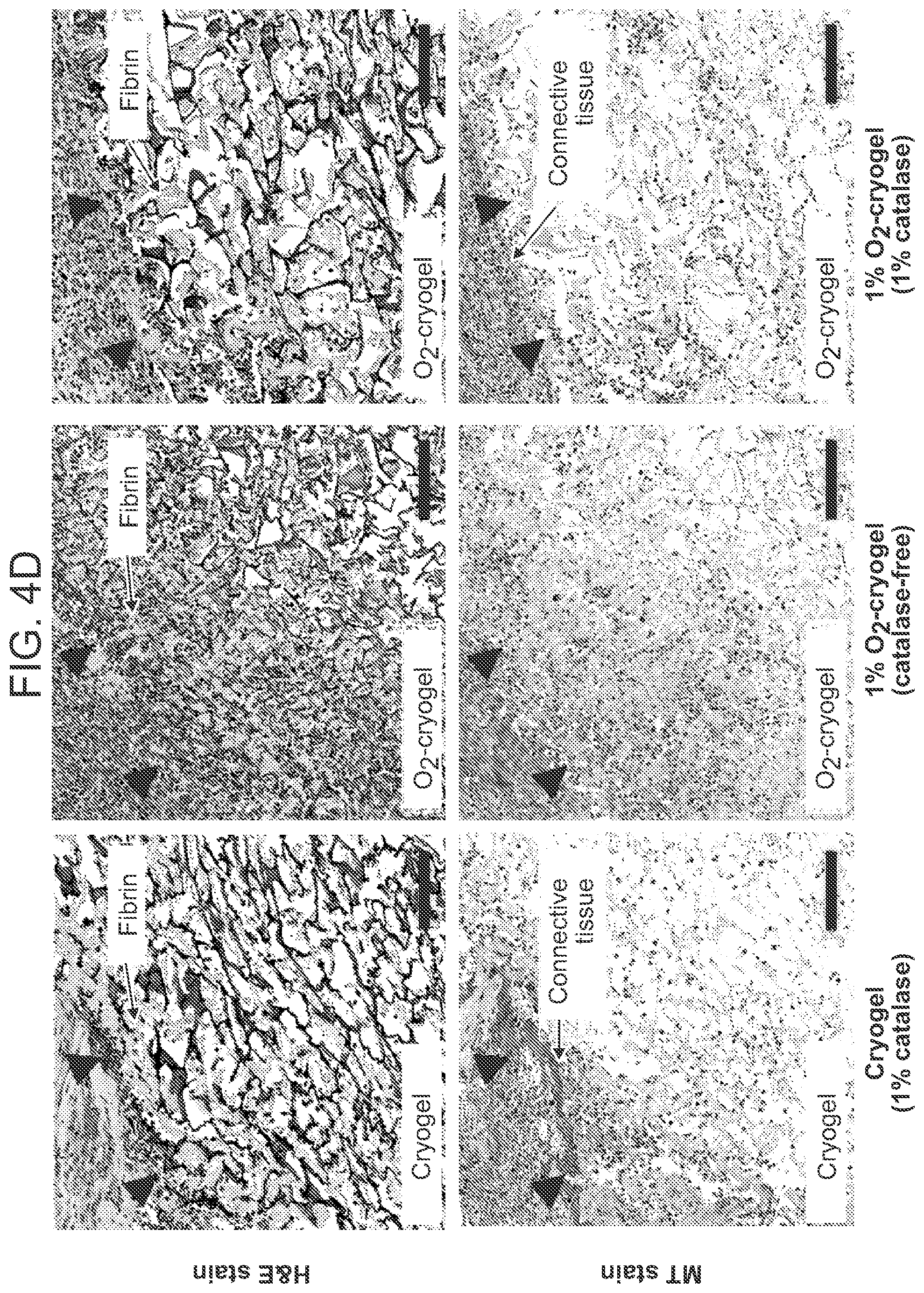 Patent US12303618 Figure 12 – Oxygen-generating cryogels