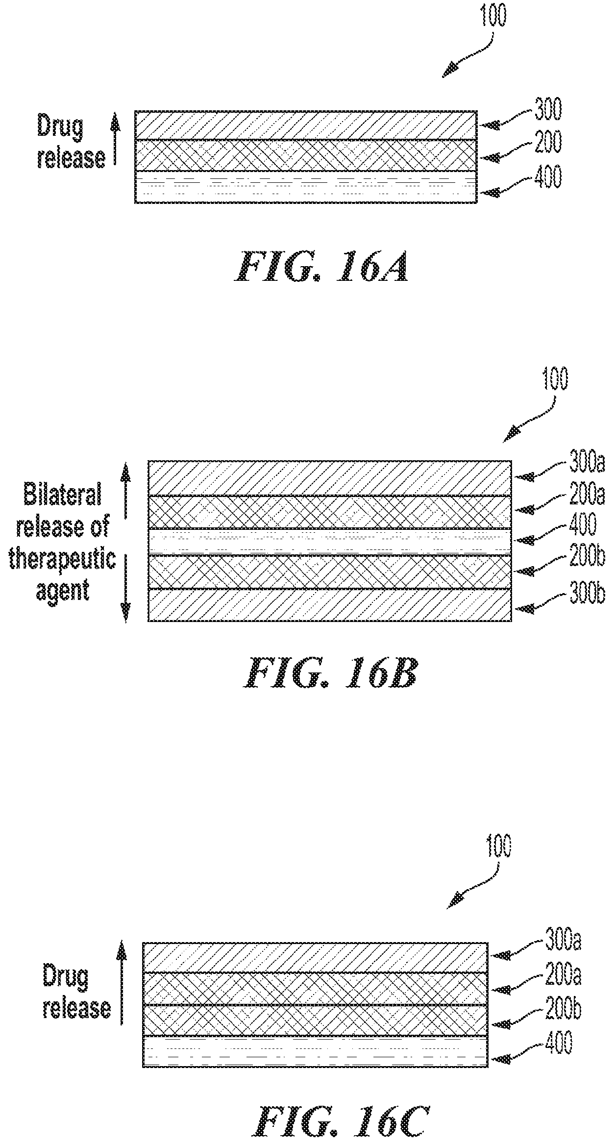 Patent US12303619 Figure 11 – Polymer implants