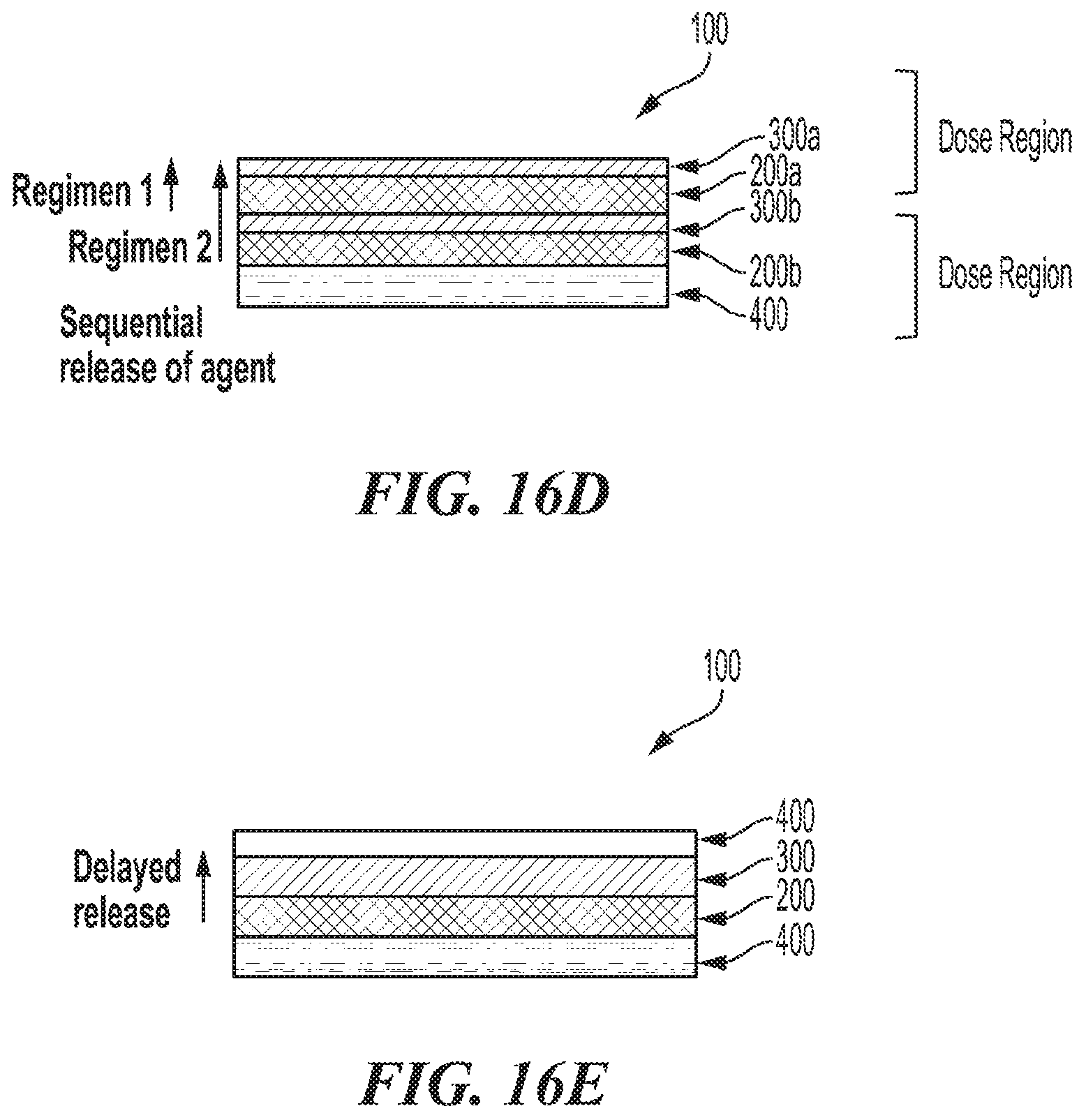 Patent US12303619 Figure 12 – Polymer implants