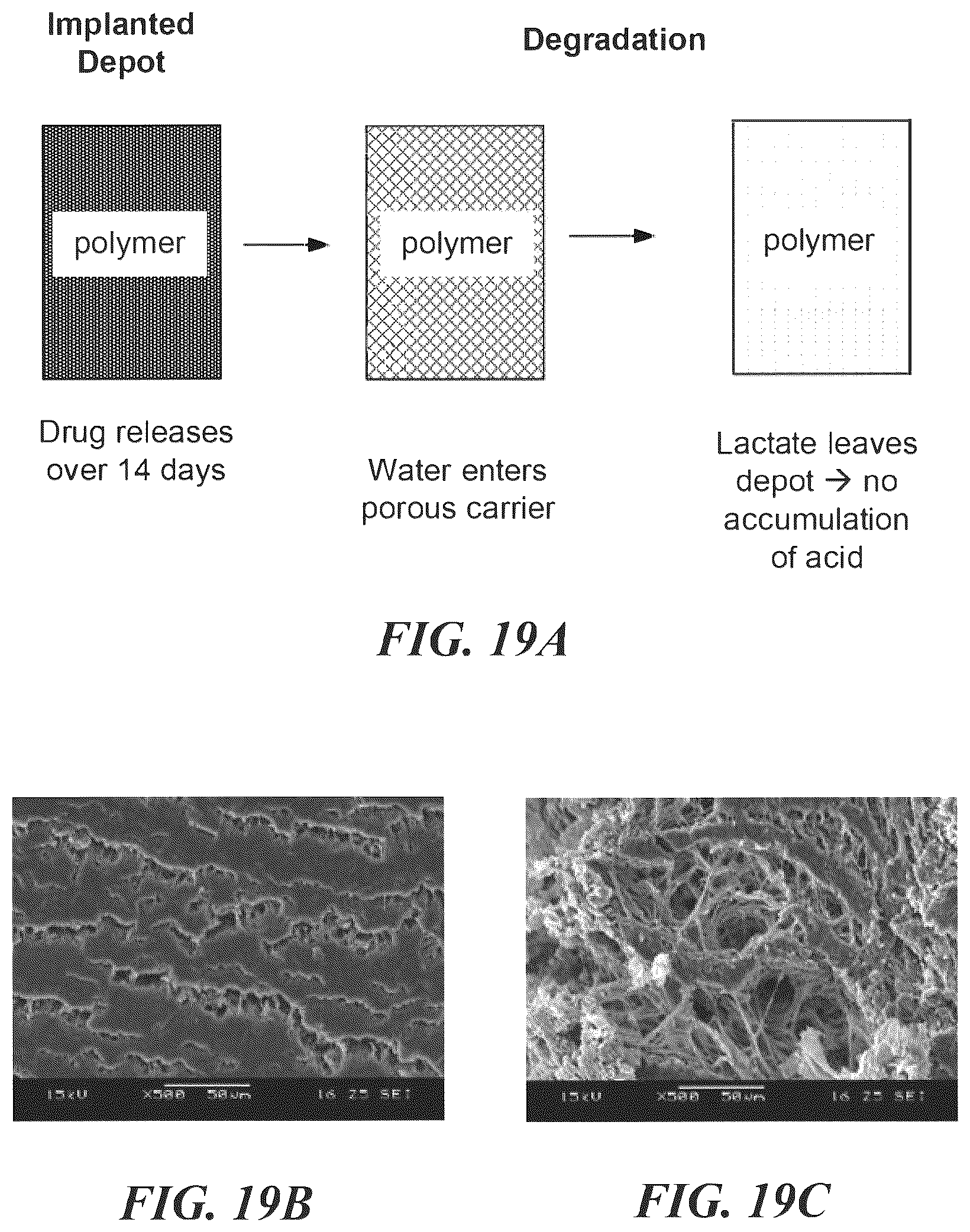 Patent US12303619 Figure 14 – Polymer implants