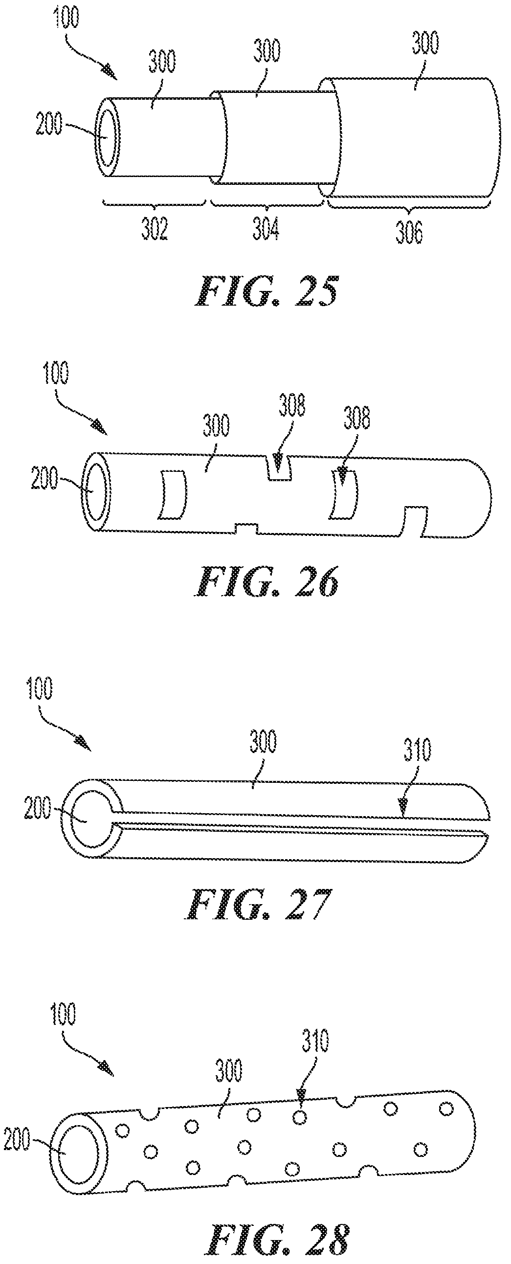 Patent US12303619 Figure 18 – Polymer implants