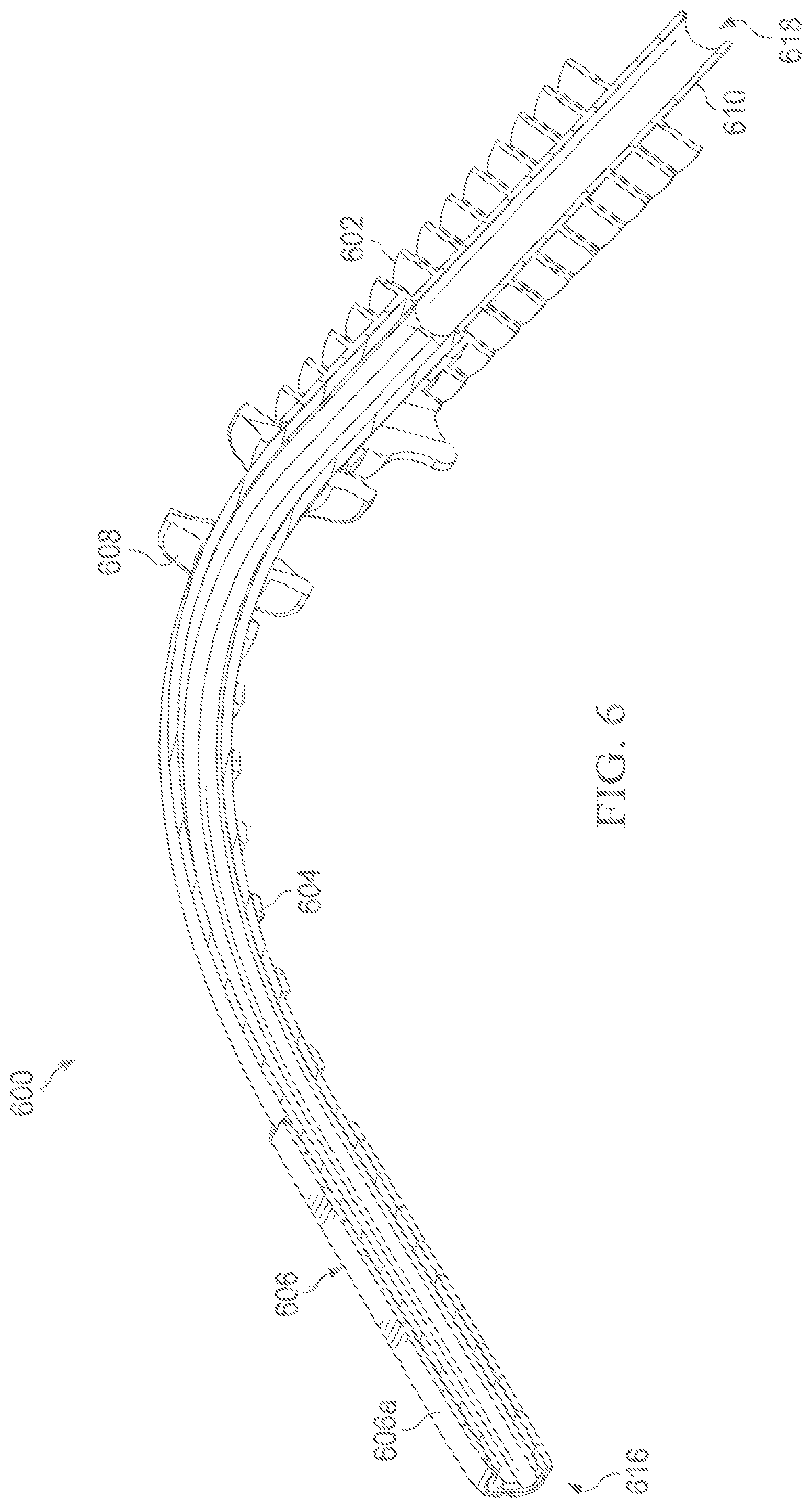 Patent US12303632 Figure 7 – Airway management device