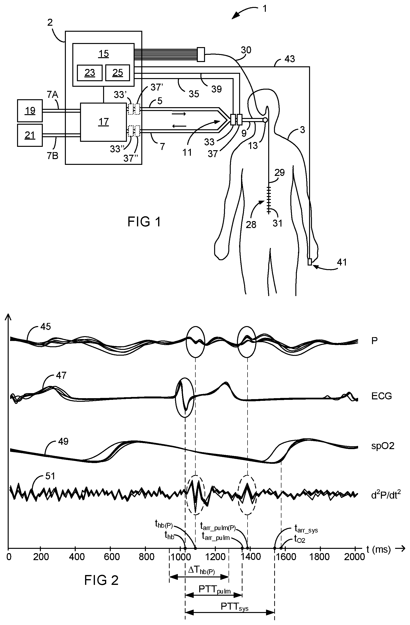 Patent US12303642 — Non-invasive estimation of hemodynamic parameters during mechanical ventilation — Figure 1